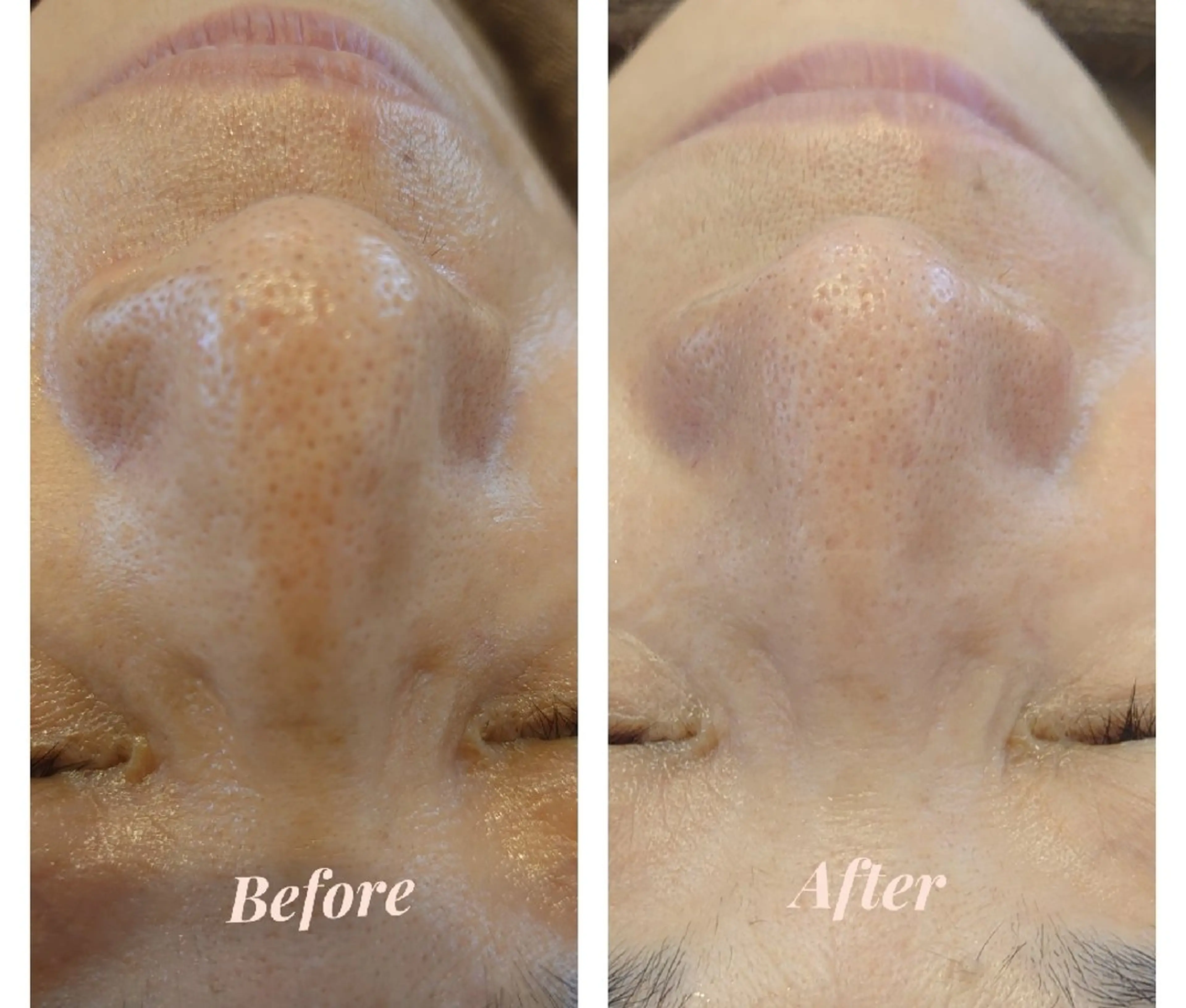 エステ M✨ Hoshi💎✨のエステ・リラクイメージ