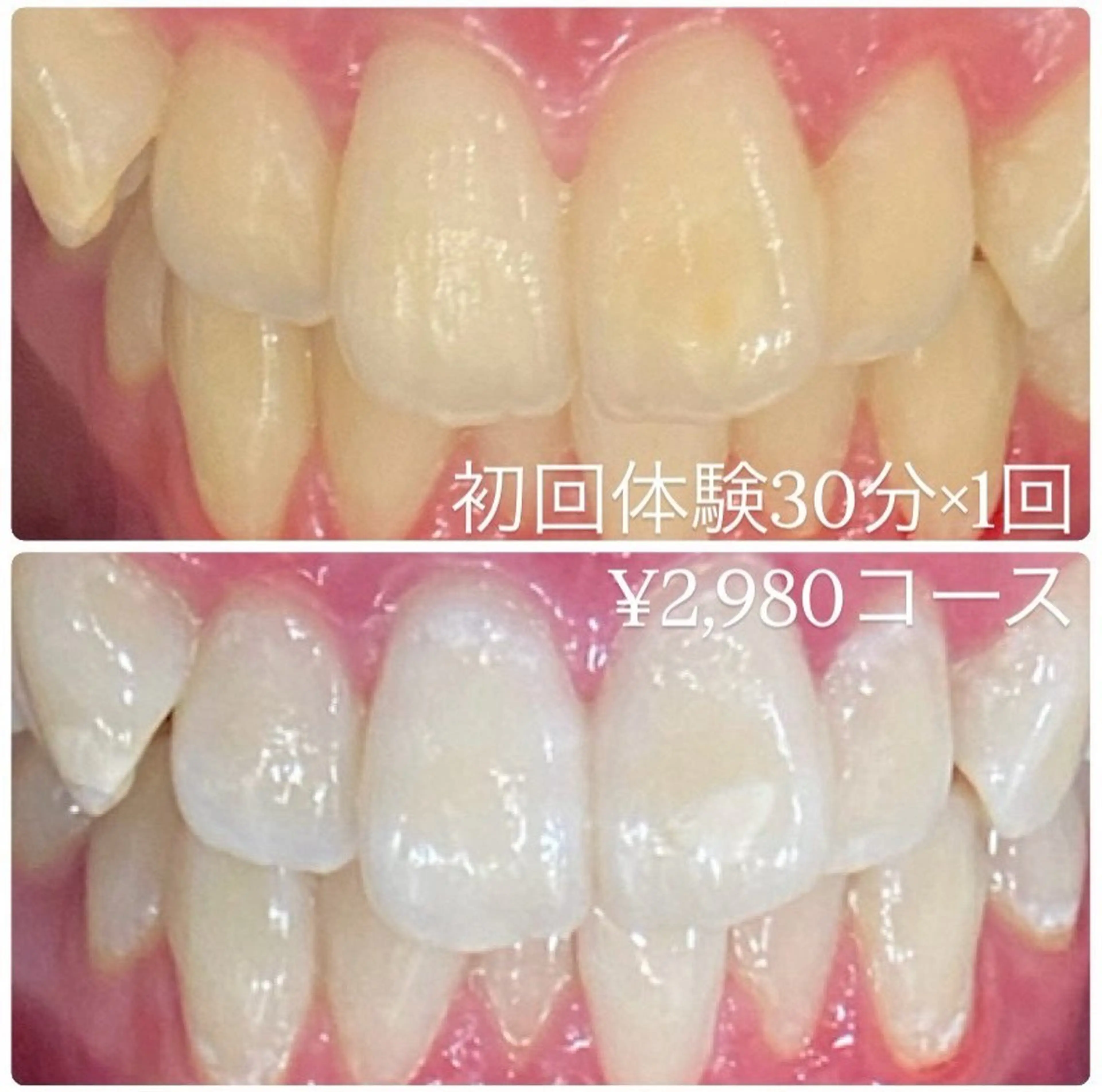 メンズ ホワイトニング ルーム　川崎店のその他イメージ