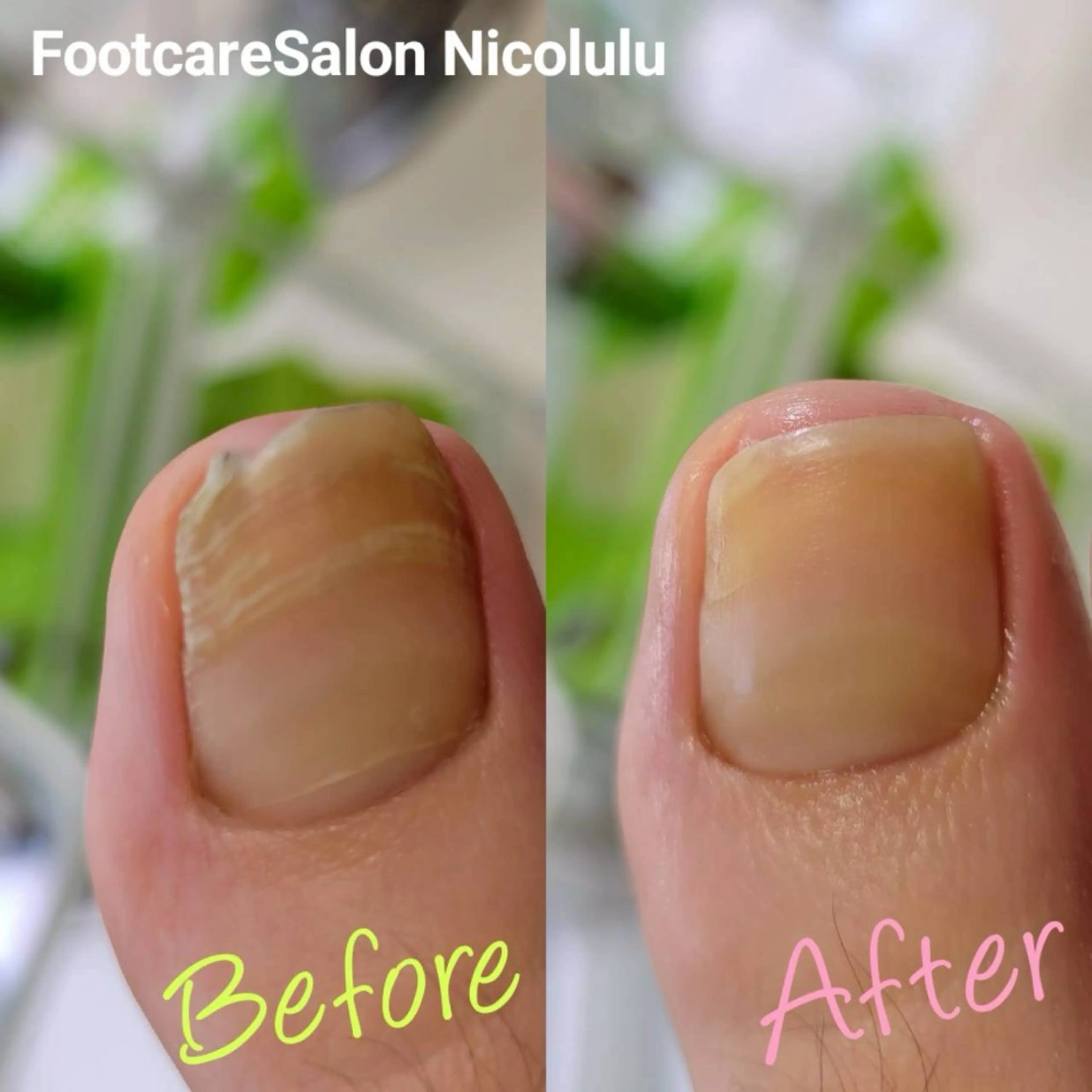 リラク 足トラブル専門 ニコルル金沢のエステ・リラクイメージ