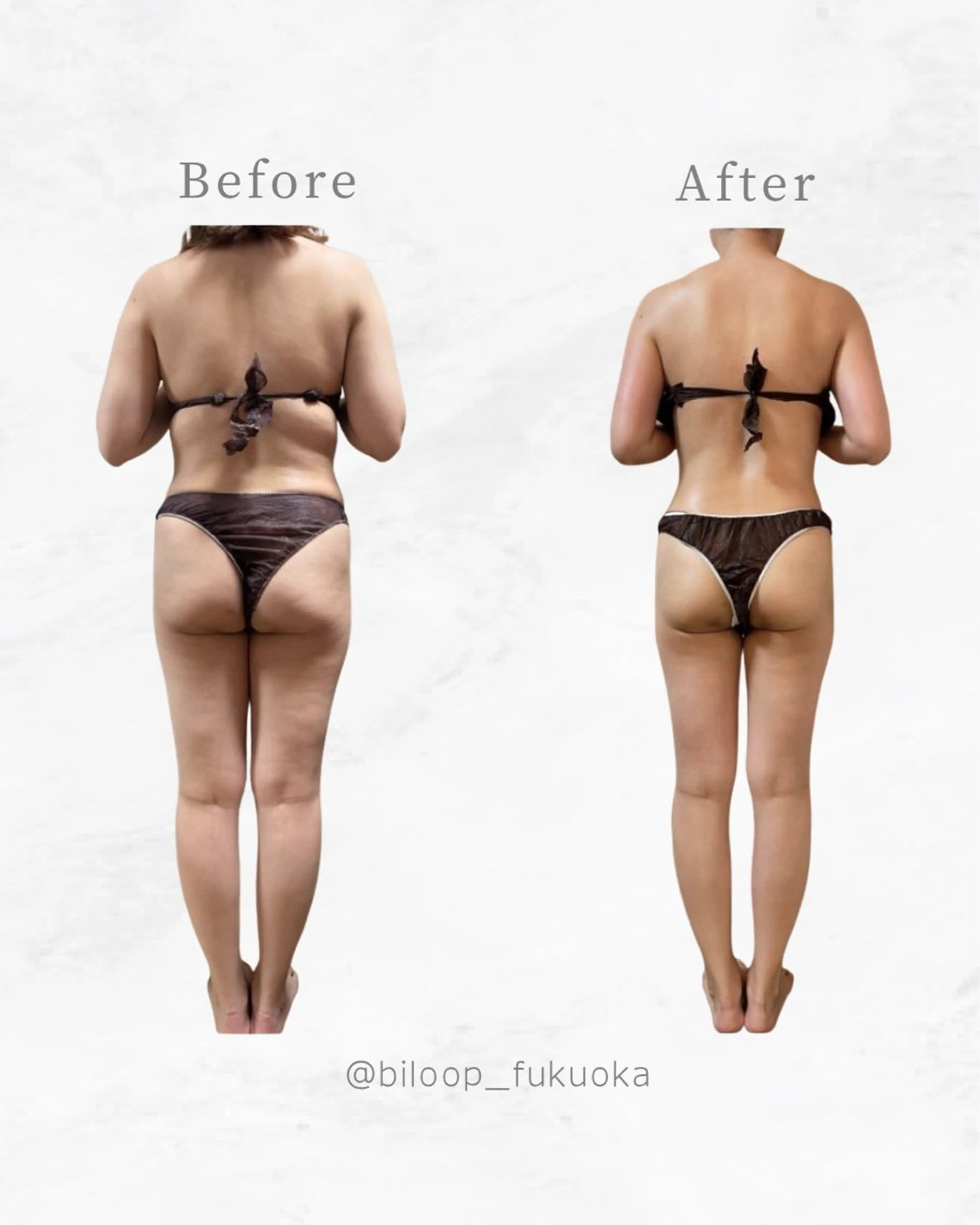 エステ リラク biloop所属・《本気痩せ×疲労改善 》  BILOOPのエステ・リラクイメージ