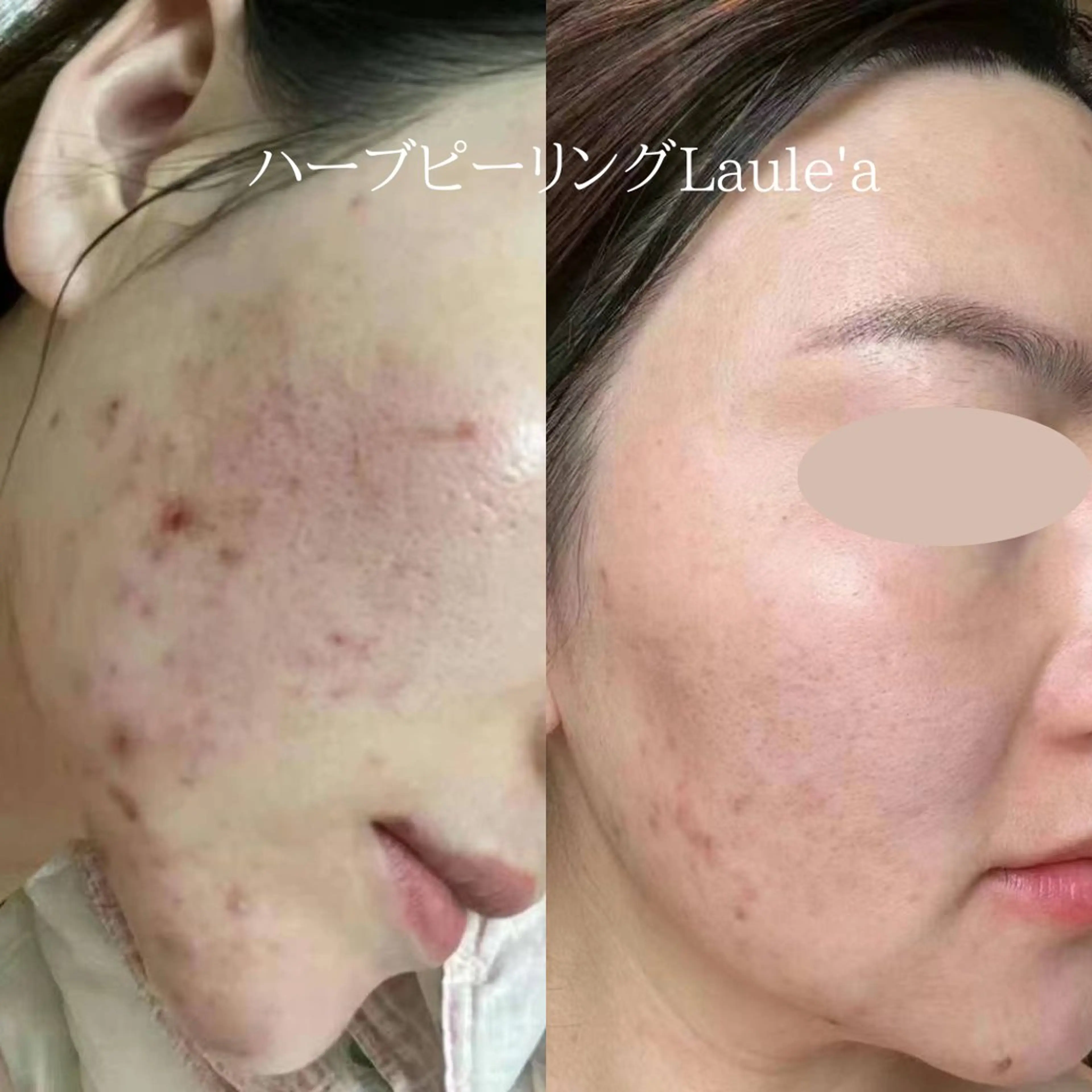 美腸サロン🌺 腸もみ/小顔/リンパのエステ・リラクイメージ