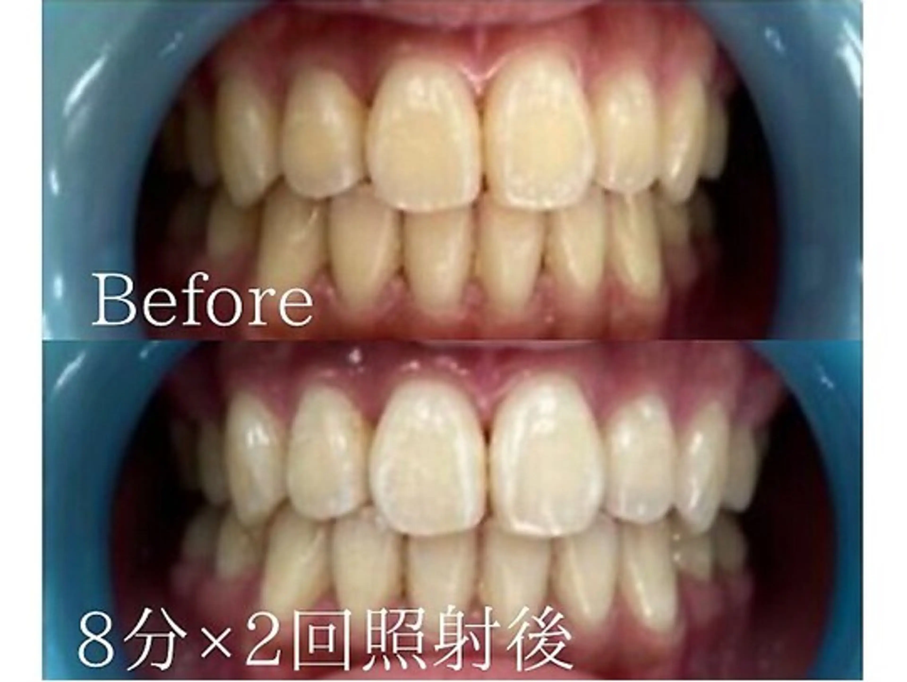 ホワイトニングカフェ 荻窪店のその他イメージ