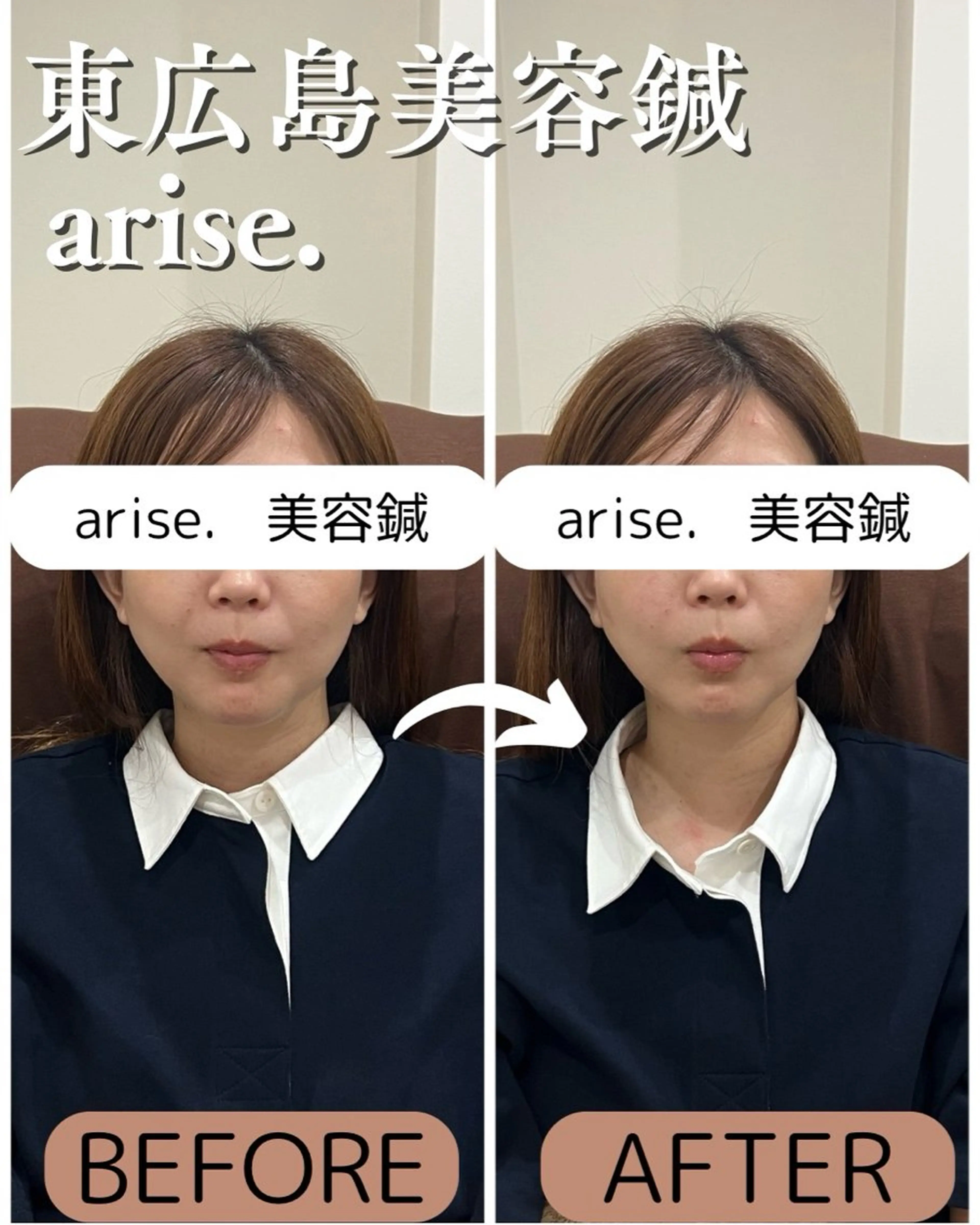 東広島美容鍼 /arise.のその他イメージ