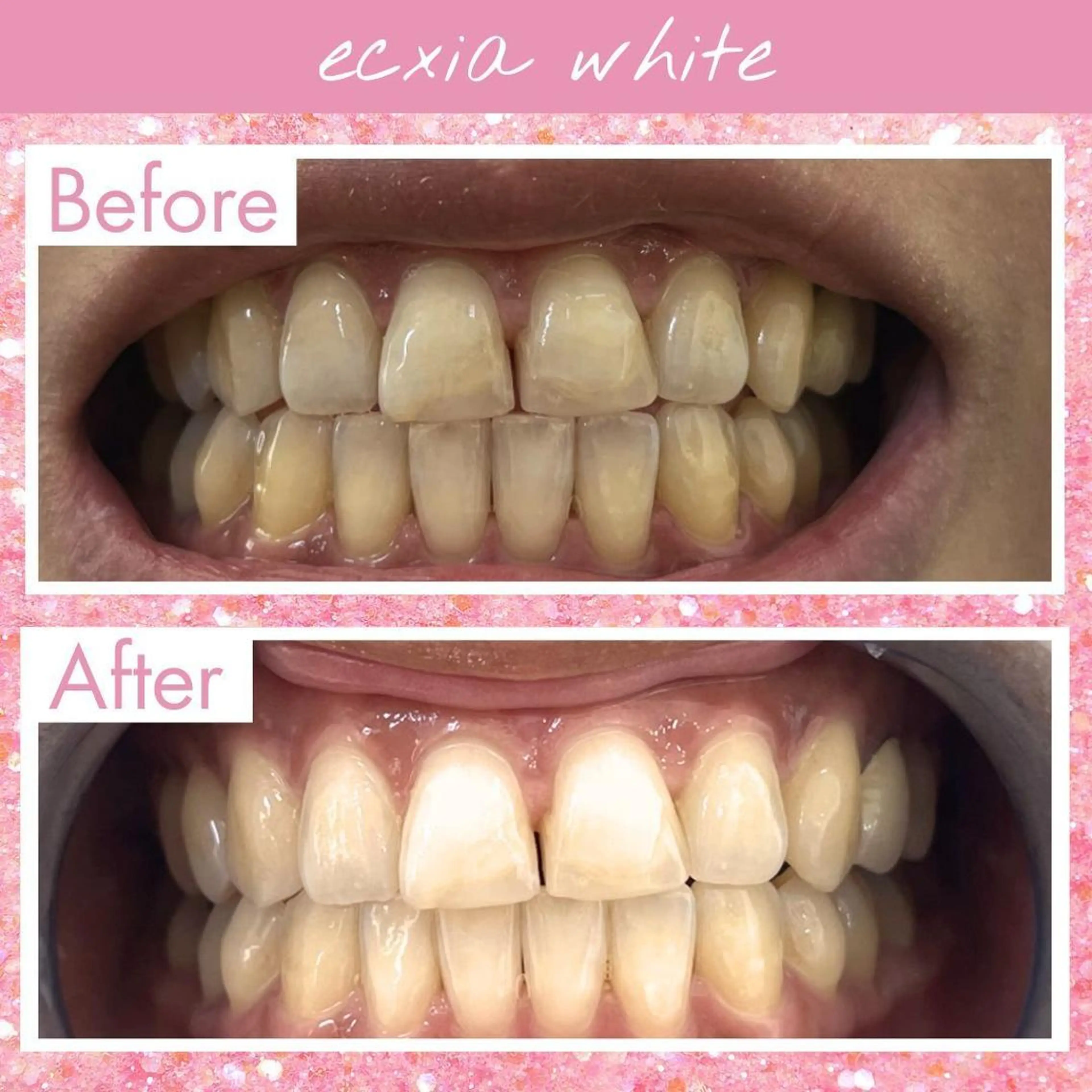 その他 ecxia新白河店 ゆきのその他イメージ