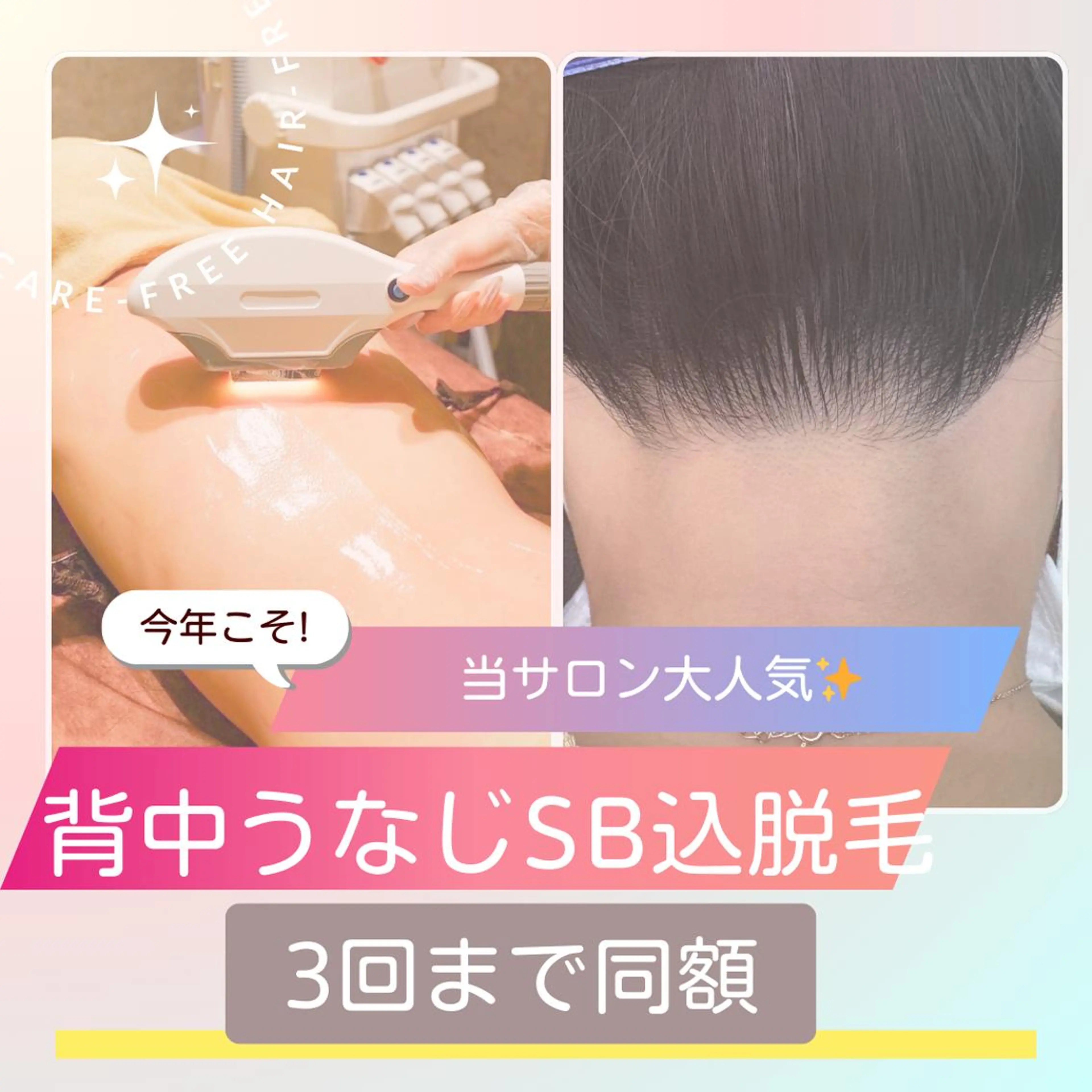 4月キャンペーン🩵うなじ背中「デザインシェービング込み」脱毛  ￥6600円→￥4400円の写真