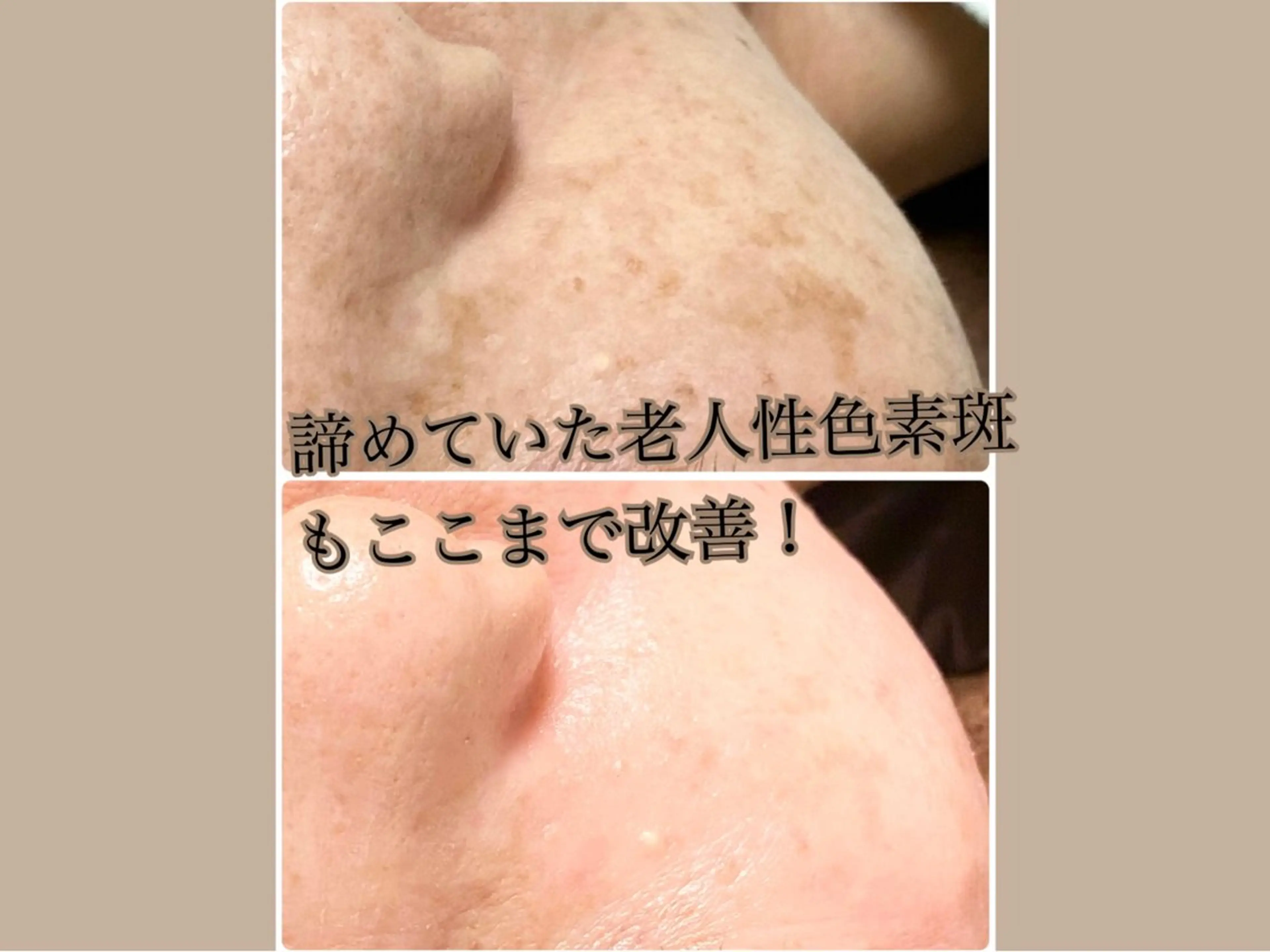 エステ Welina  Pono beauty salon所属・加藤 美有のエステ・リラクイメージ