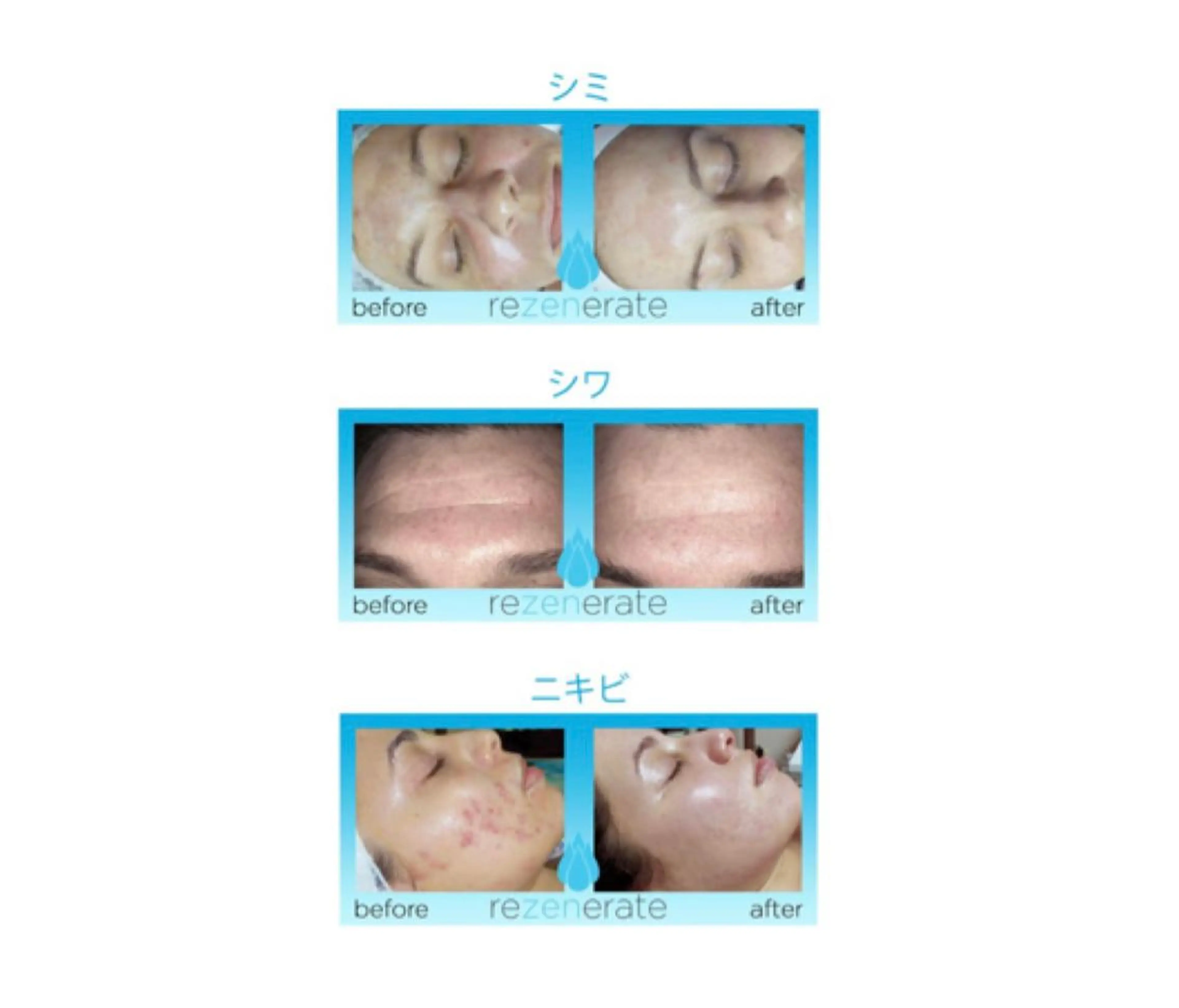 エステ Ailes de Ange　MARIのエステ・リラクイメージ