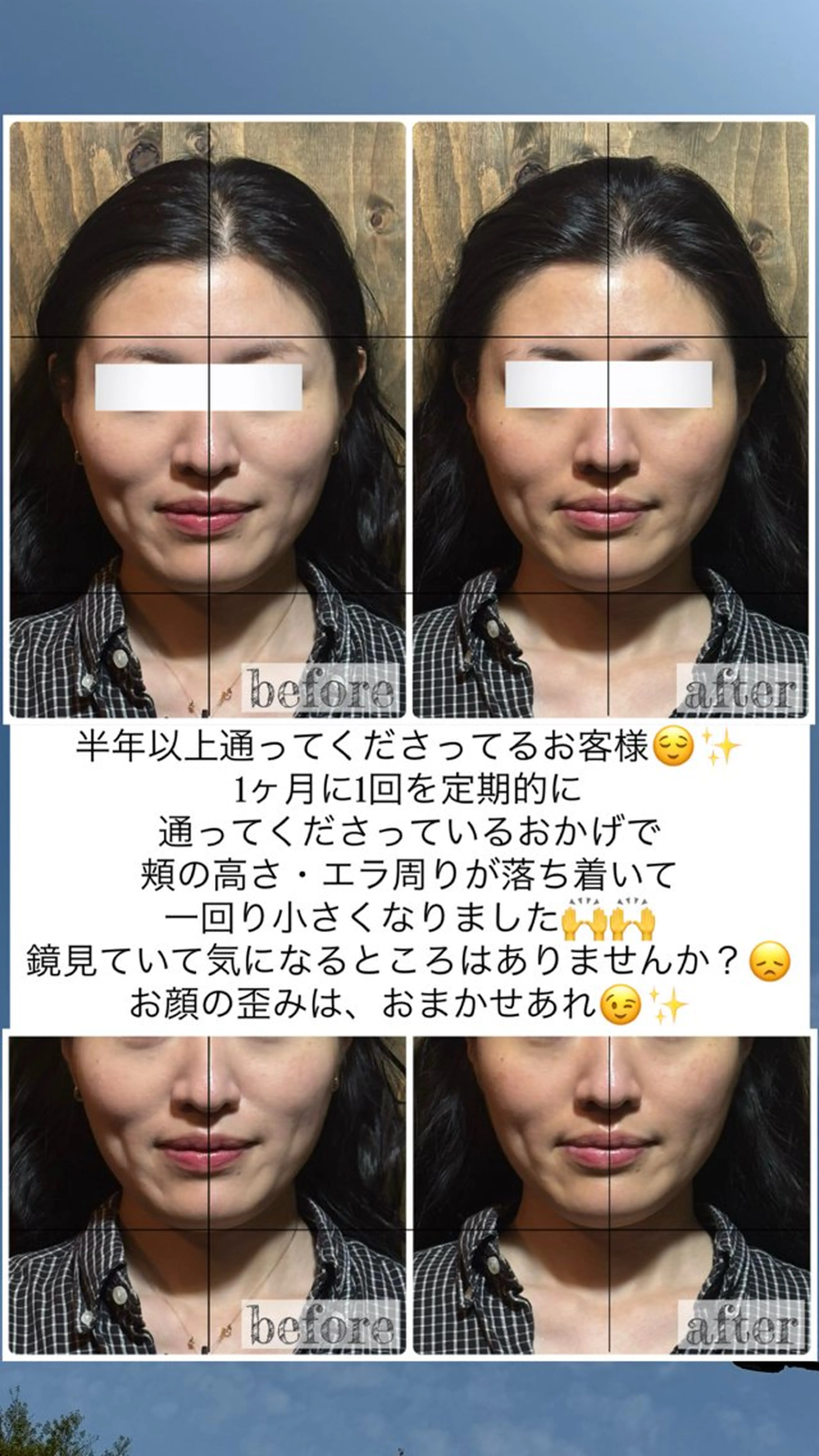 エステ リラク 💎後悔させない小顔 矯正💎イトヤマ🌱のエステ・リラクイメージ