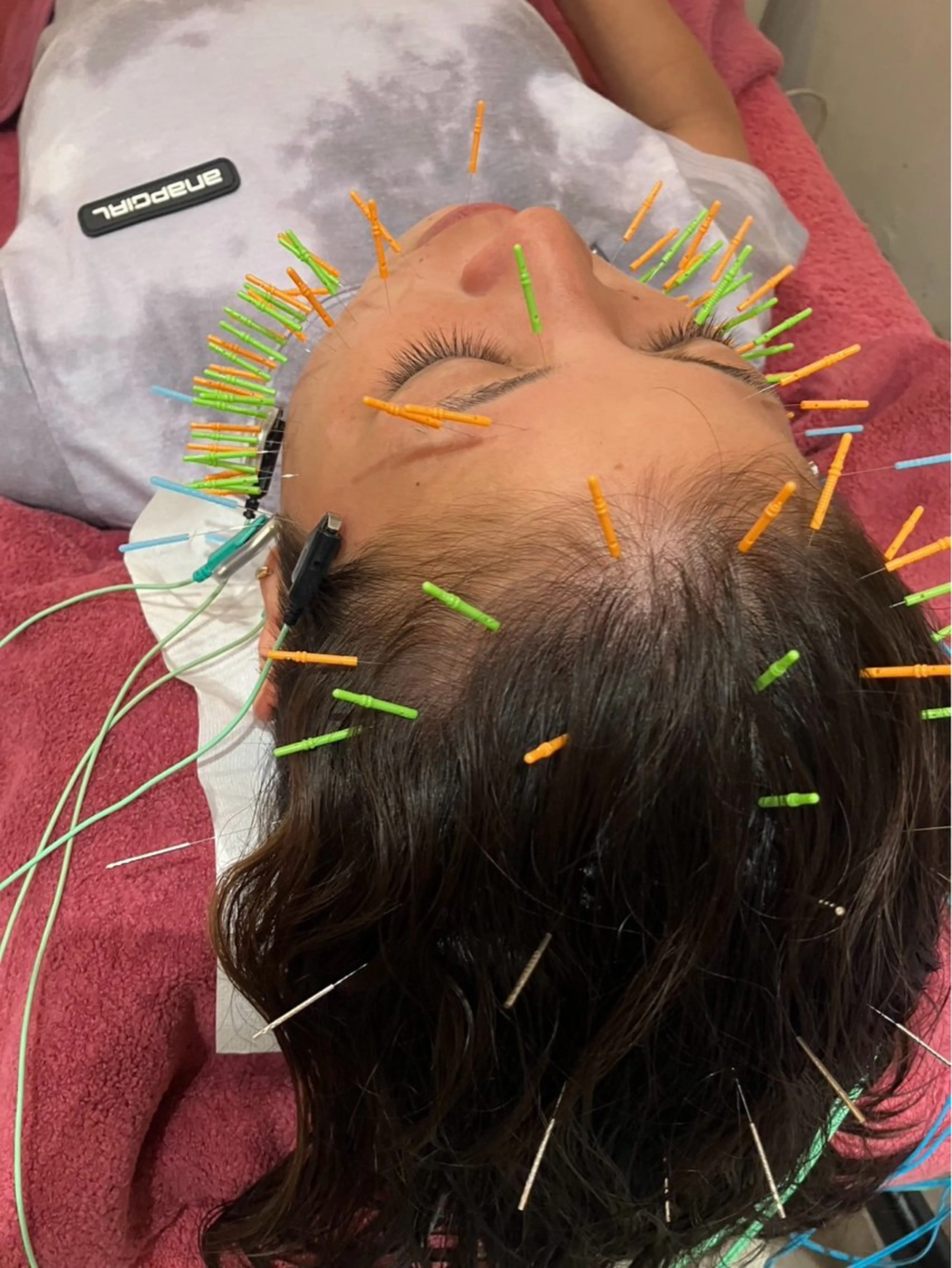 エステ リラク 美容鍼灸女性専用 りんご鍼灸治療院のその他イメージ