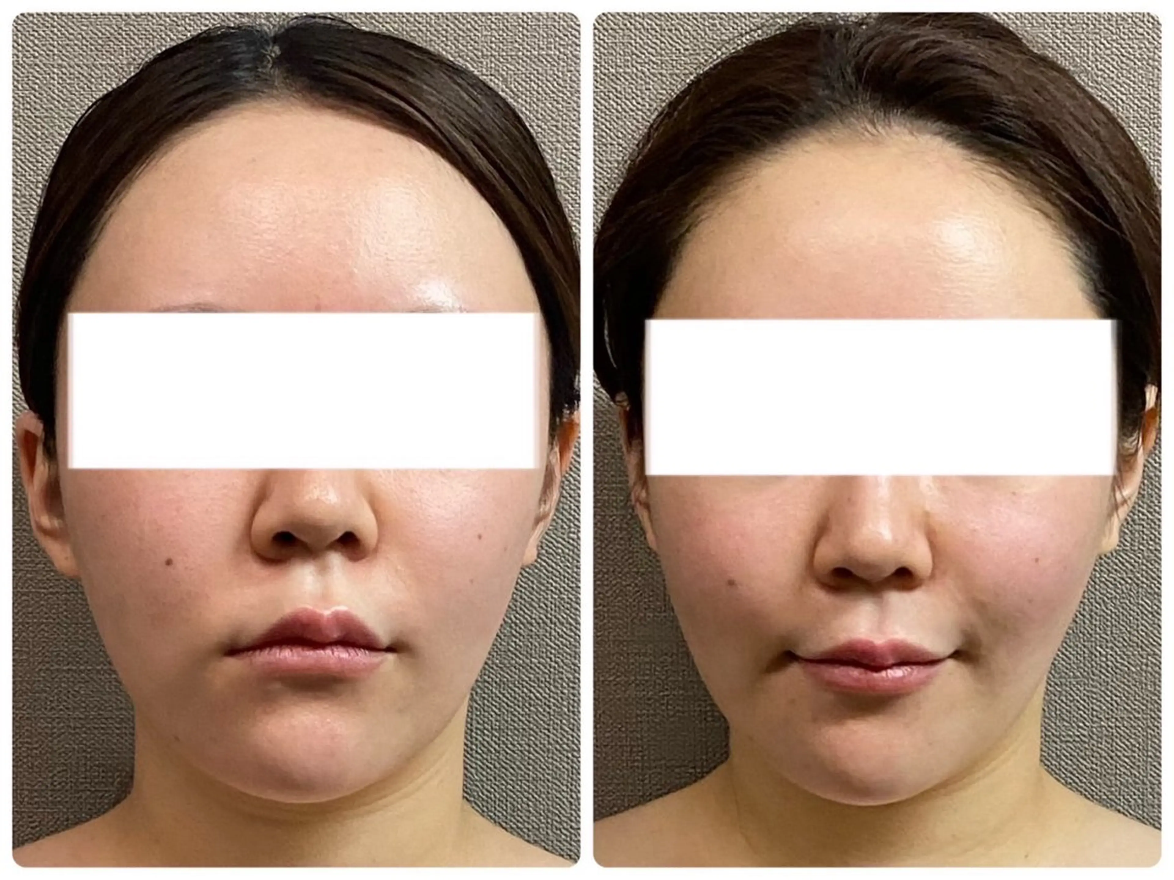 MIRAI小顔 溝の口店のエステ・リラクイメージ