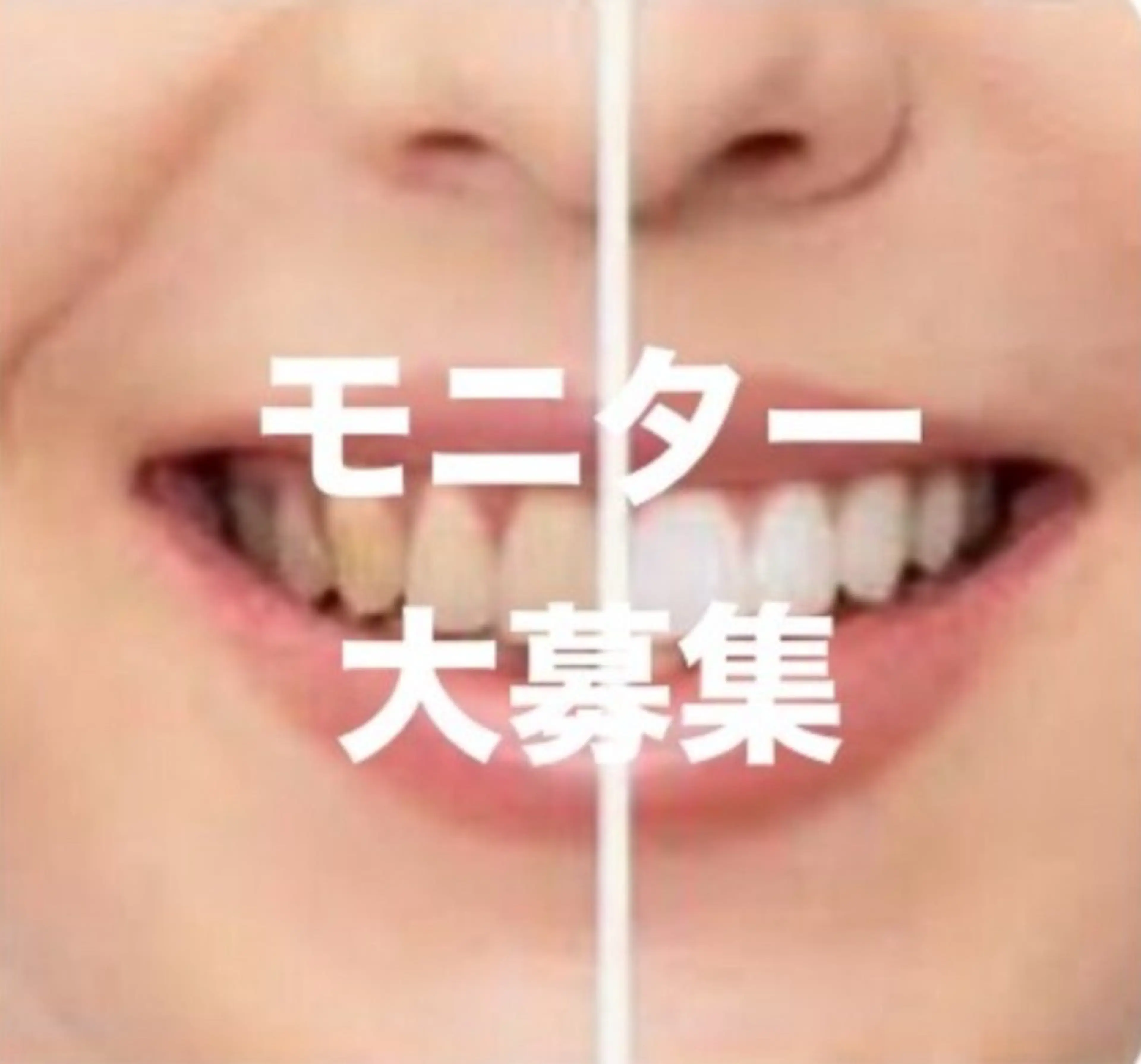 ホワイトニング ビューティ名古屋栄のその他イメージ