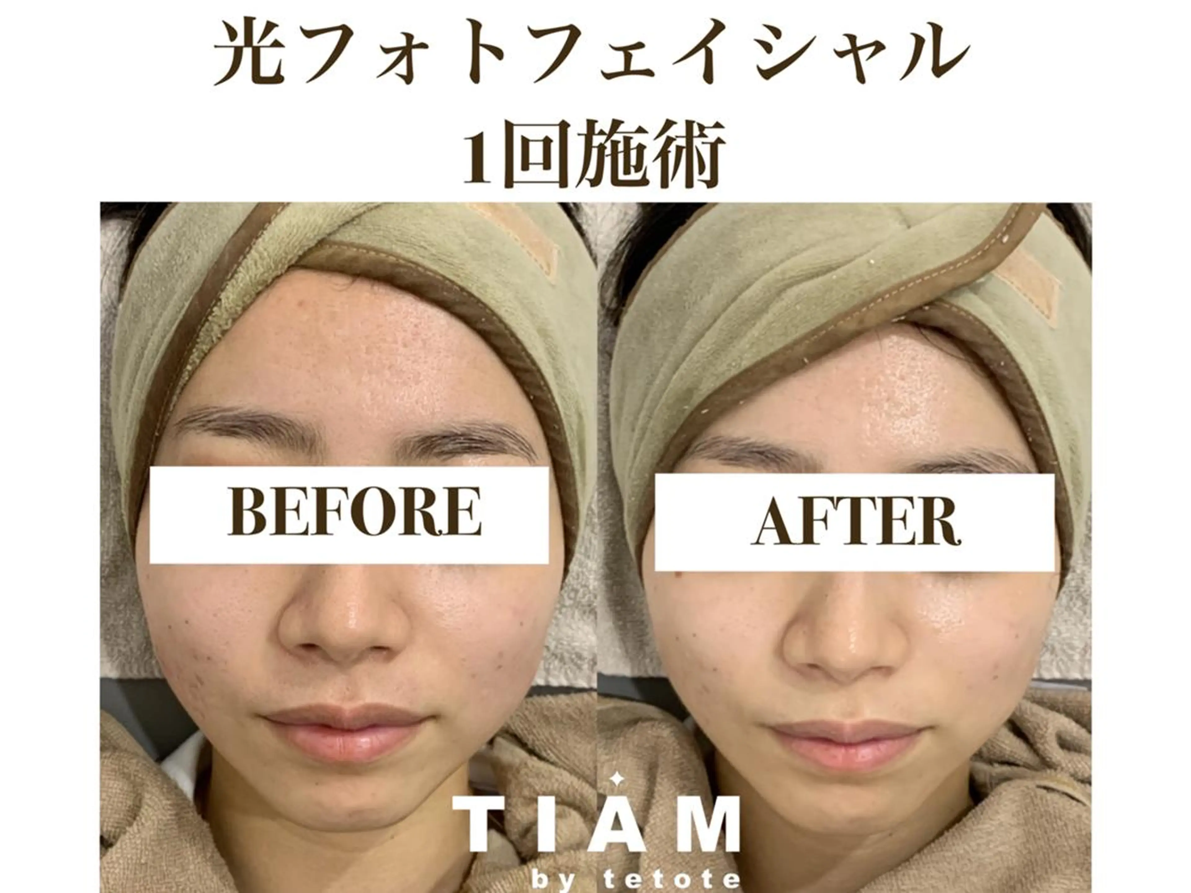 美肌サロンTIAM by tetoteのエステ・リラクイメージ