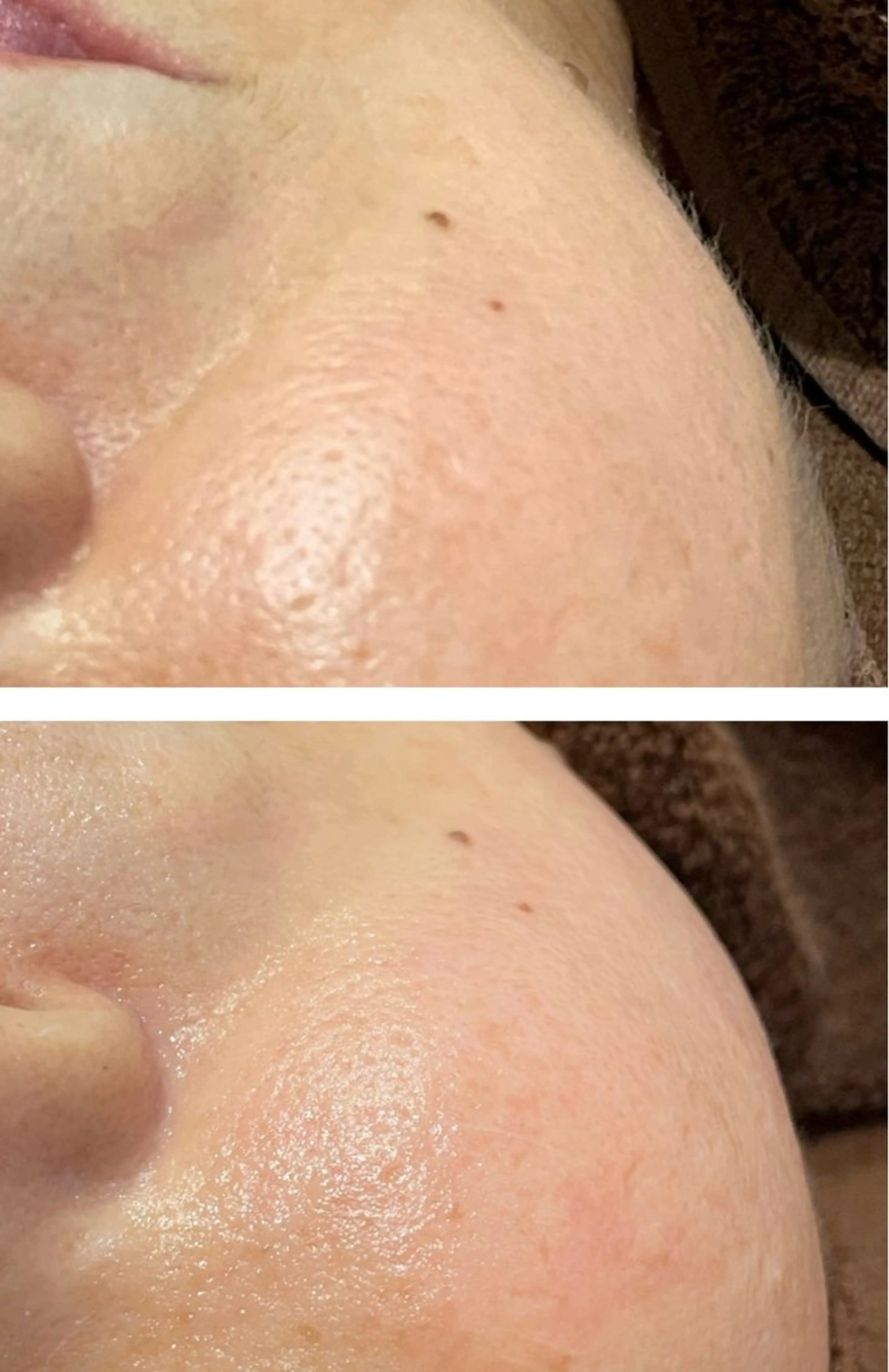 肌質改善◇結果重視 美麗-MIREI-のエステ・リラクイメージ