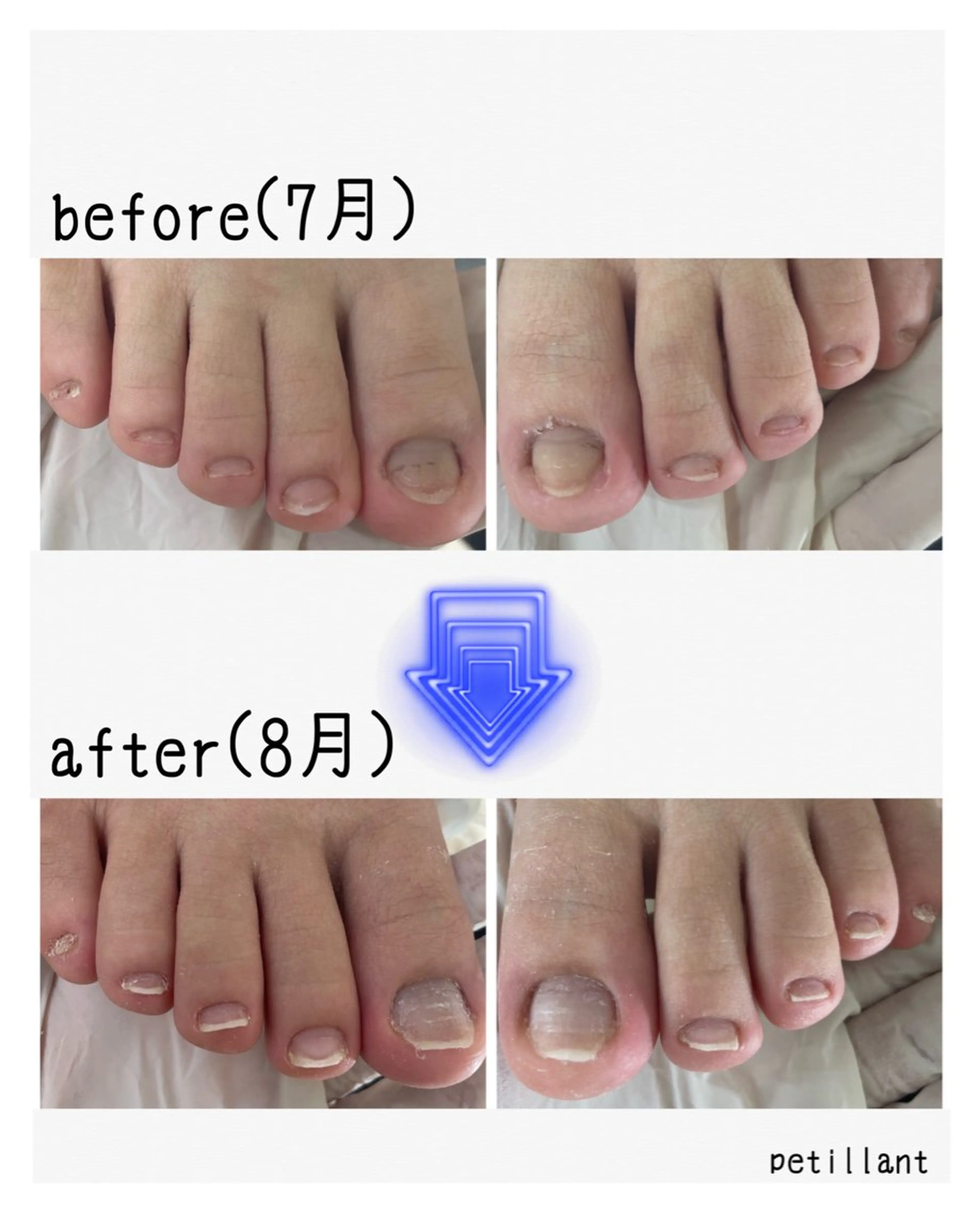 ネイル 長さ出し フットネイル ジェルネイル nail salon petillantのネイルデザイン
