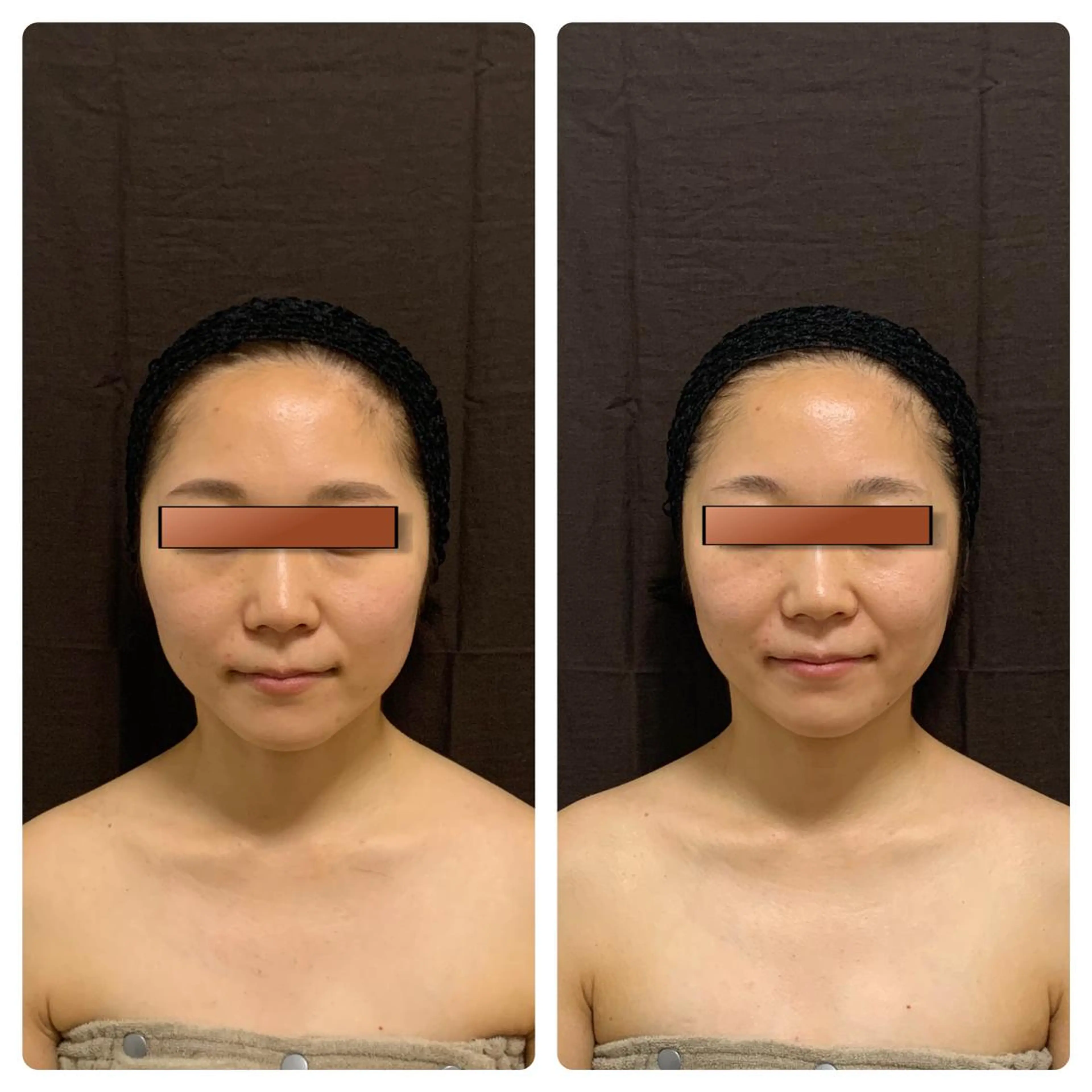 韓国式小顔矯正 担当ゆいのエステ・リラクイメージ