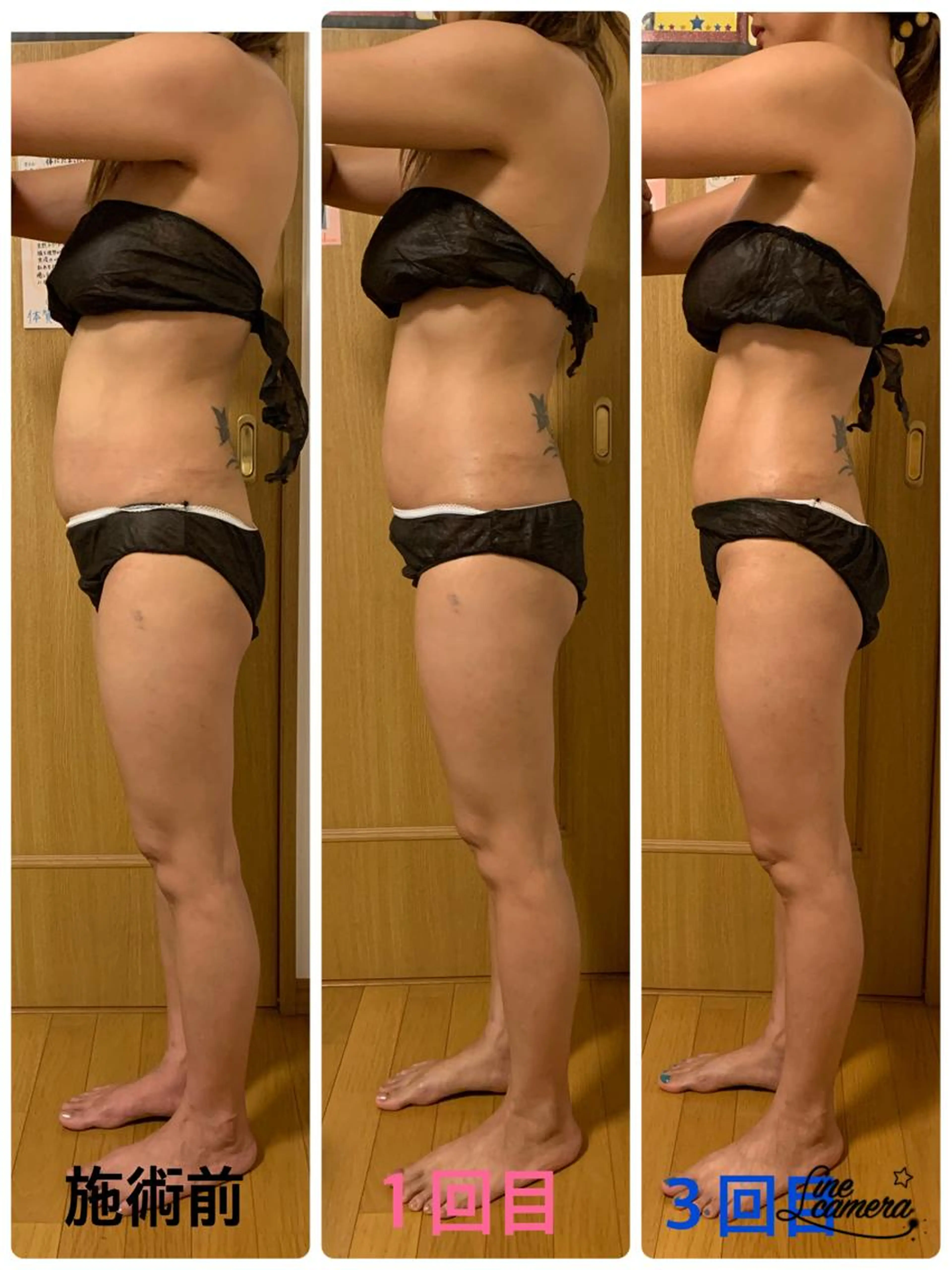 女性　インド式全身リンパマッサージ(痩身)ヒートマット付の写真