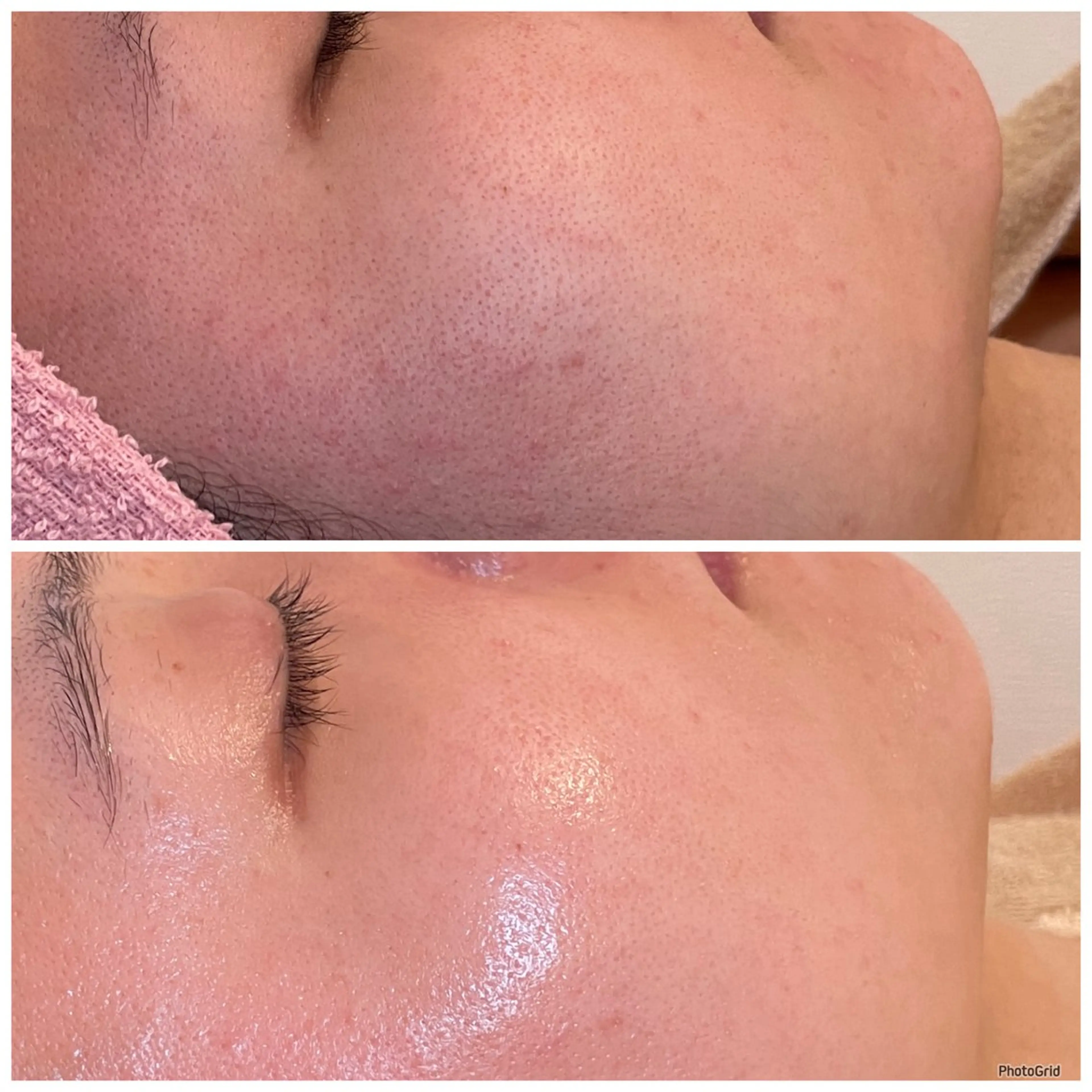 3glitter 肌質改善＆痩身のエステ・リラクイメージ