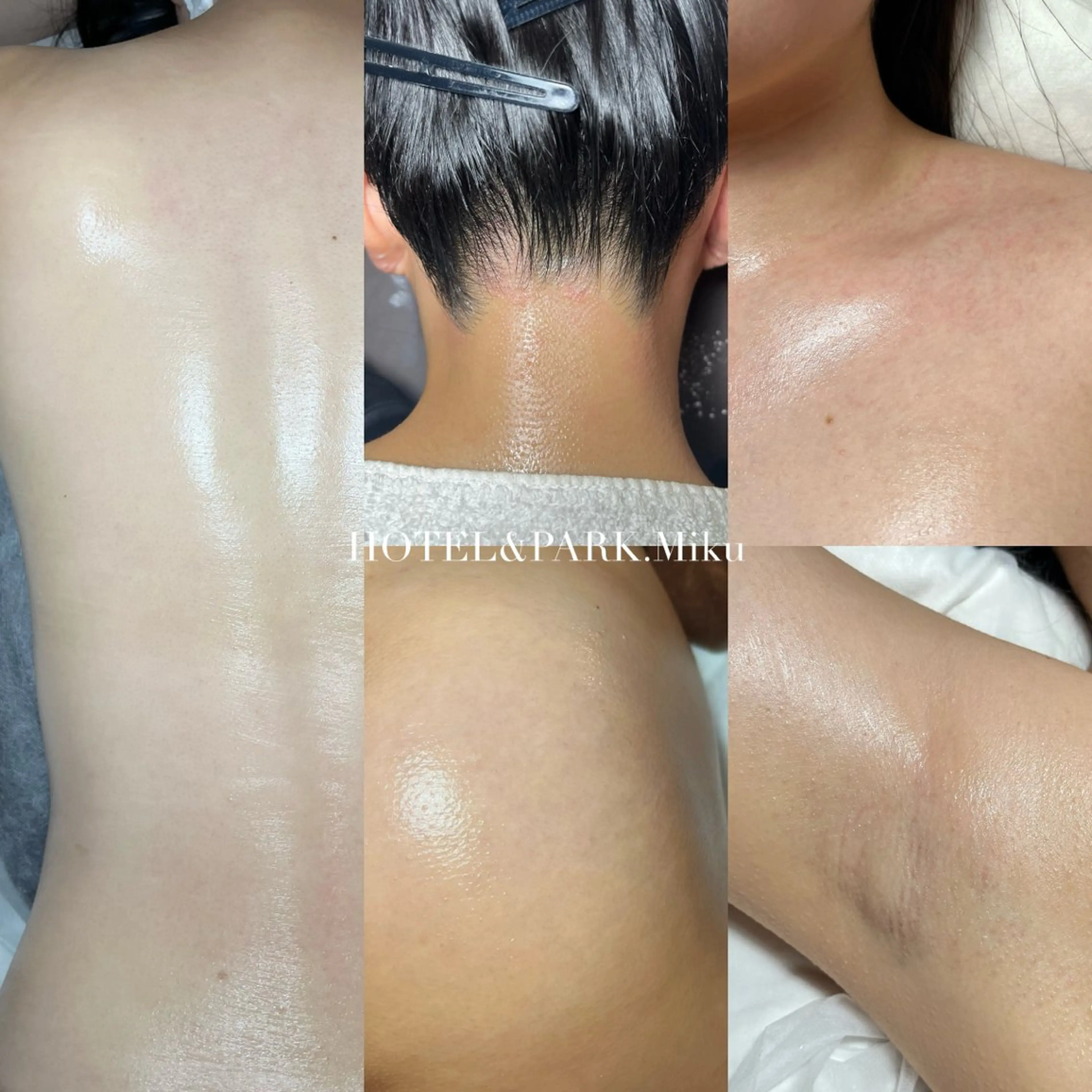 HOTEL&PARK . ワックス脱毛のエステ・リラクイメージ