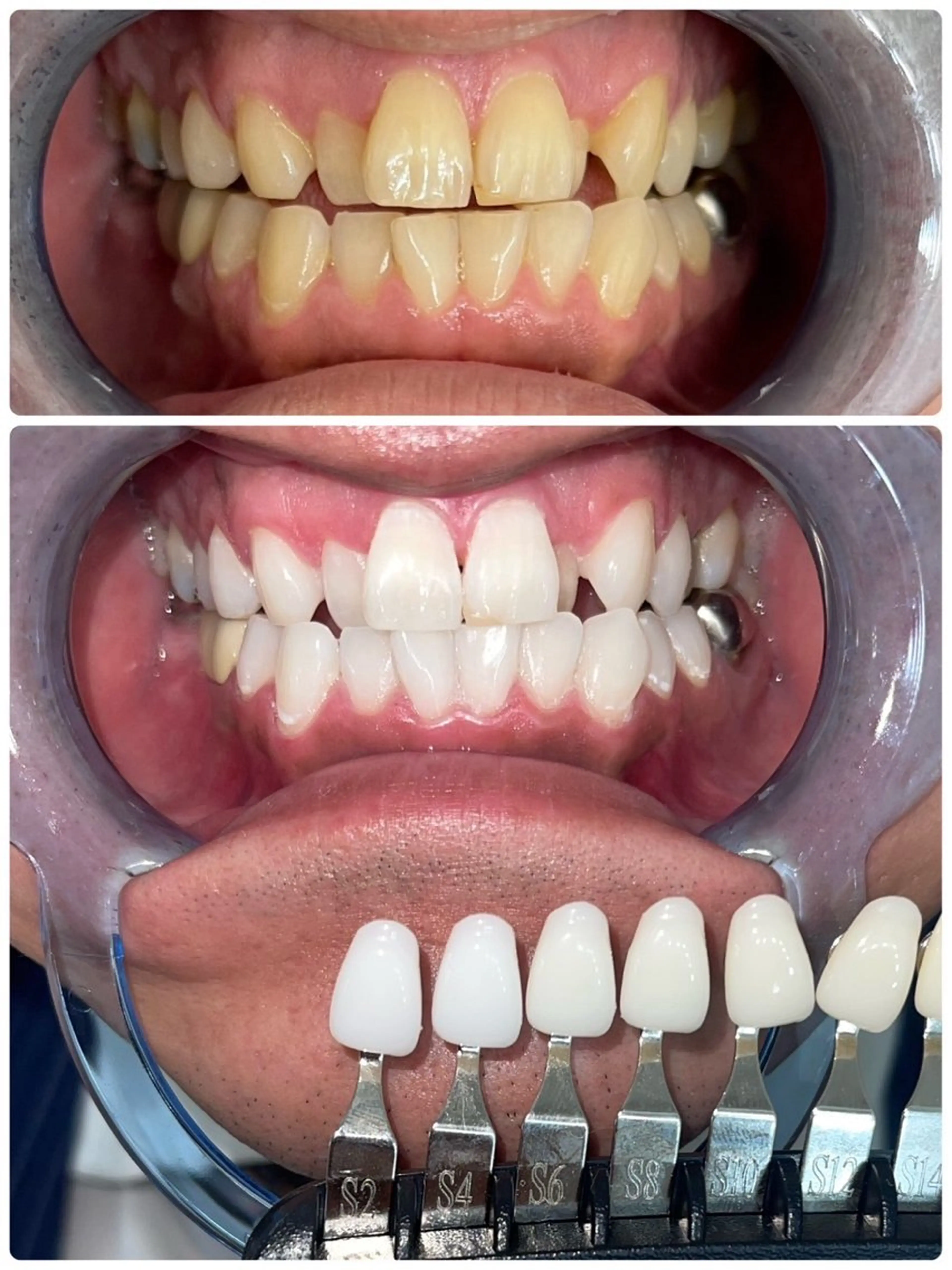 セルフホワイトニング エクシア徳島店マユのその他イメージ