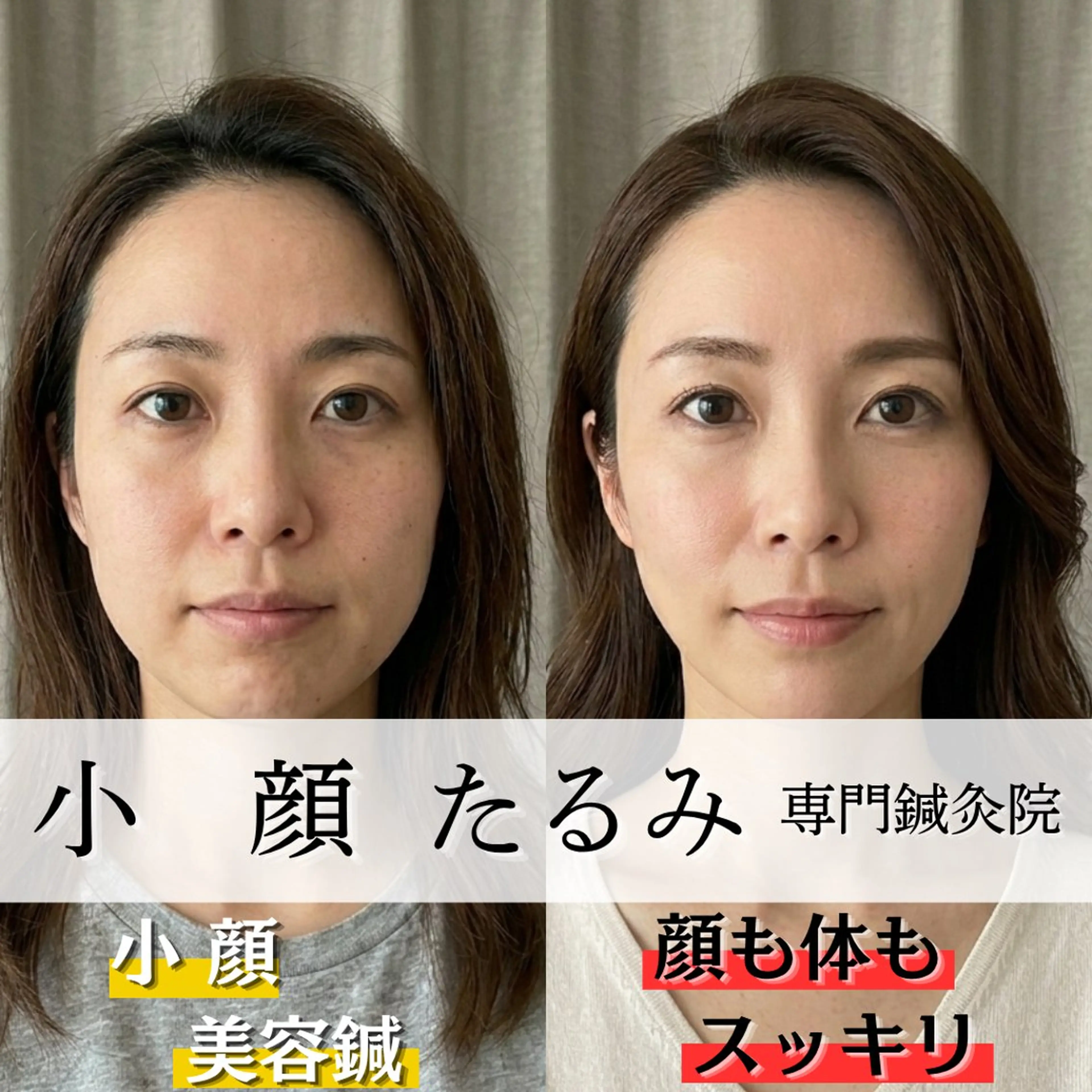 小顔・たるみ専門 DAZZLEのエステ・リラクイメージ