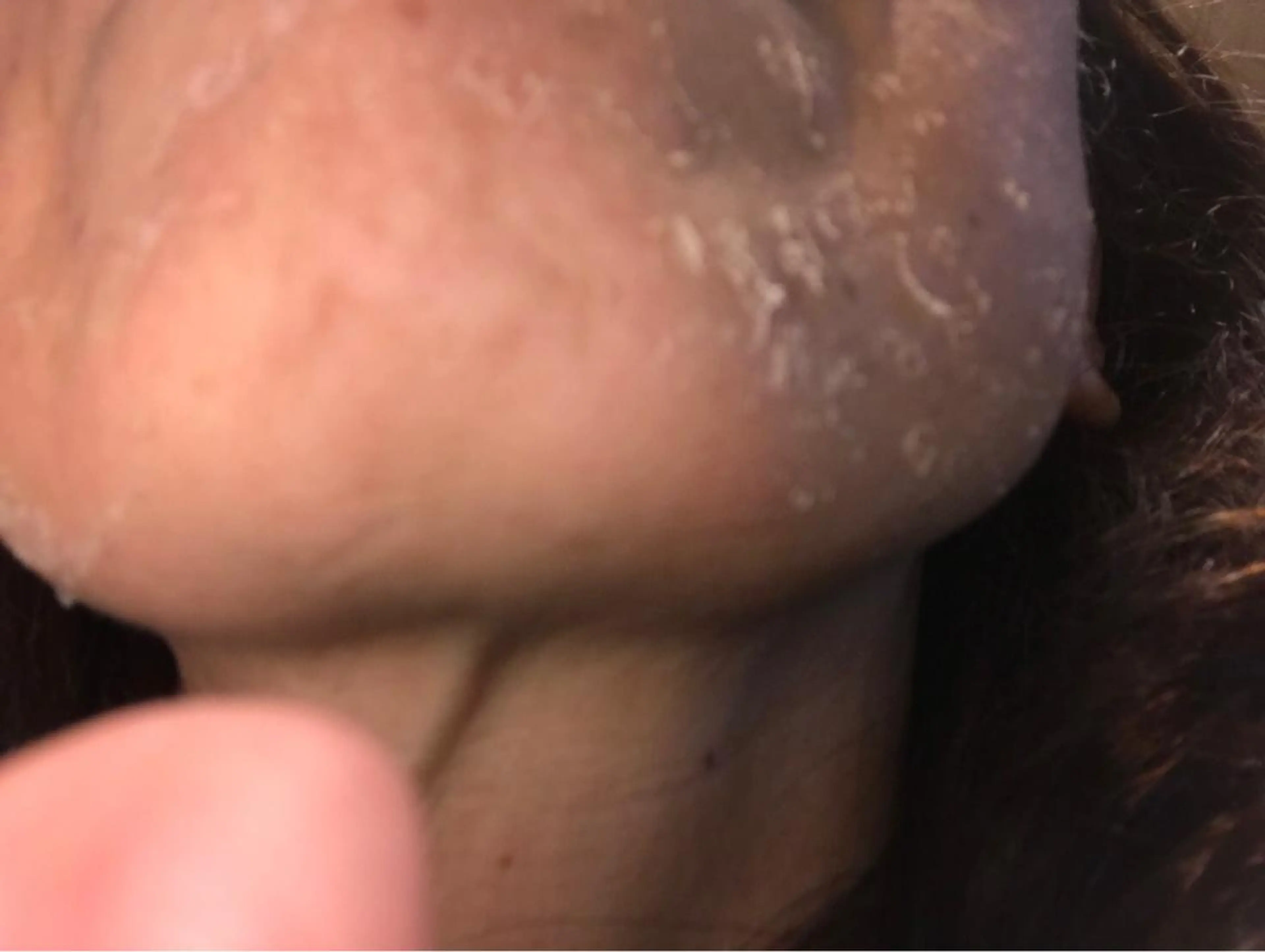 スポンジアハーブでムキ卵肌！ニキビ、アトピー、シミ、シワ、タルミに！肌質改善の写真