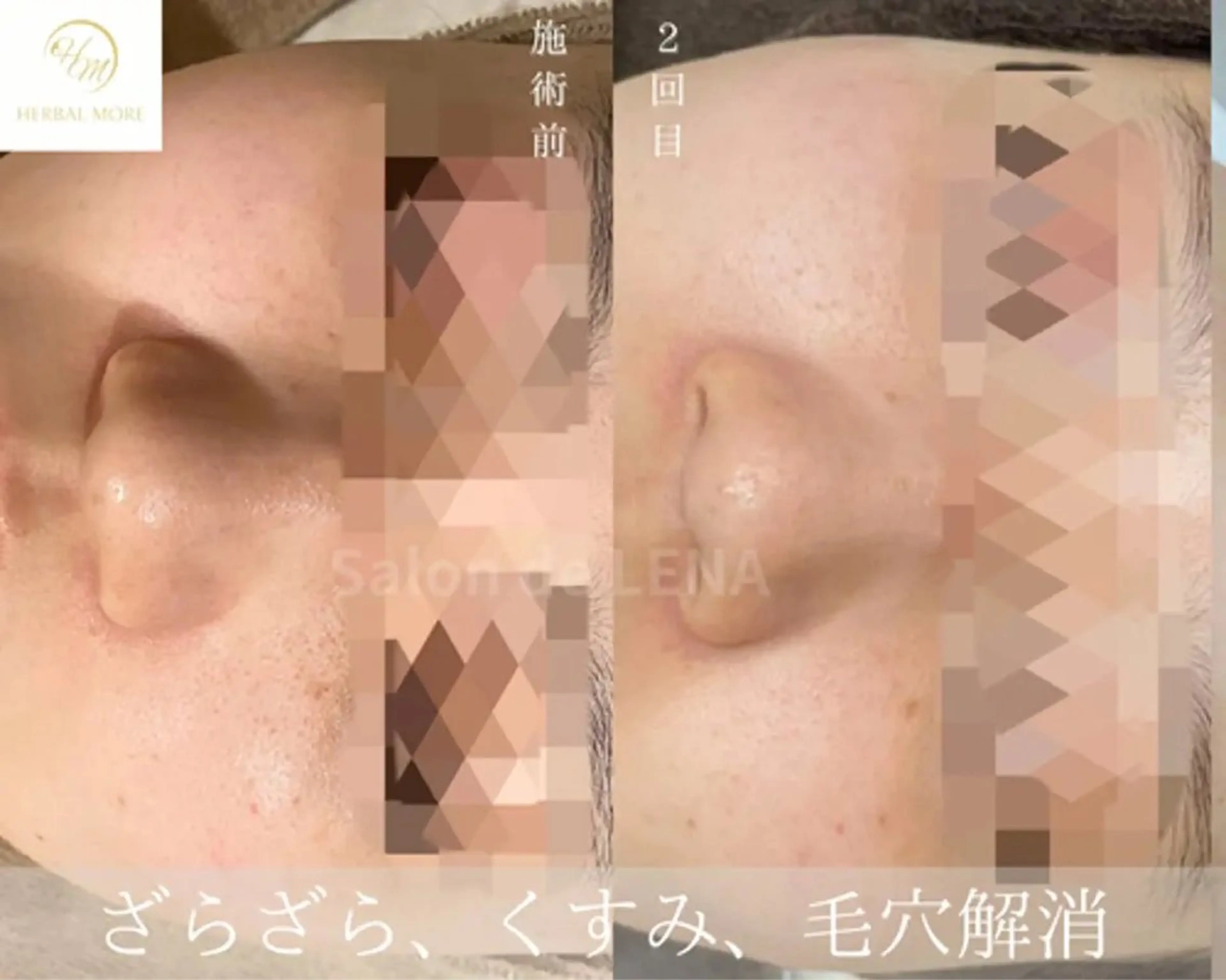 ハーブピーリング専門 グランディール　武内のエステ・リラクイメージ