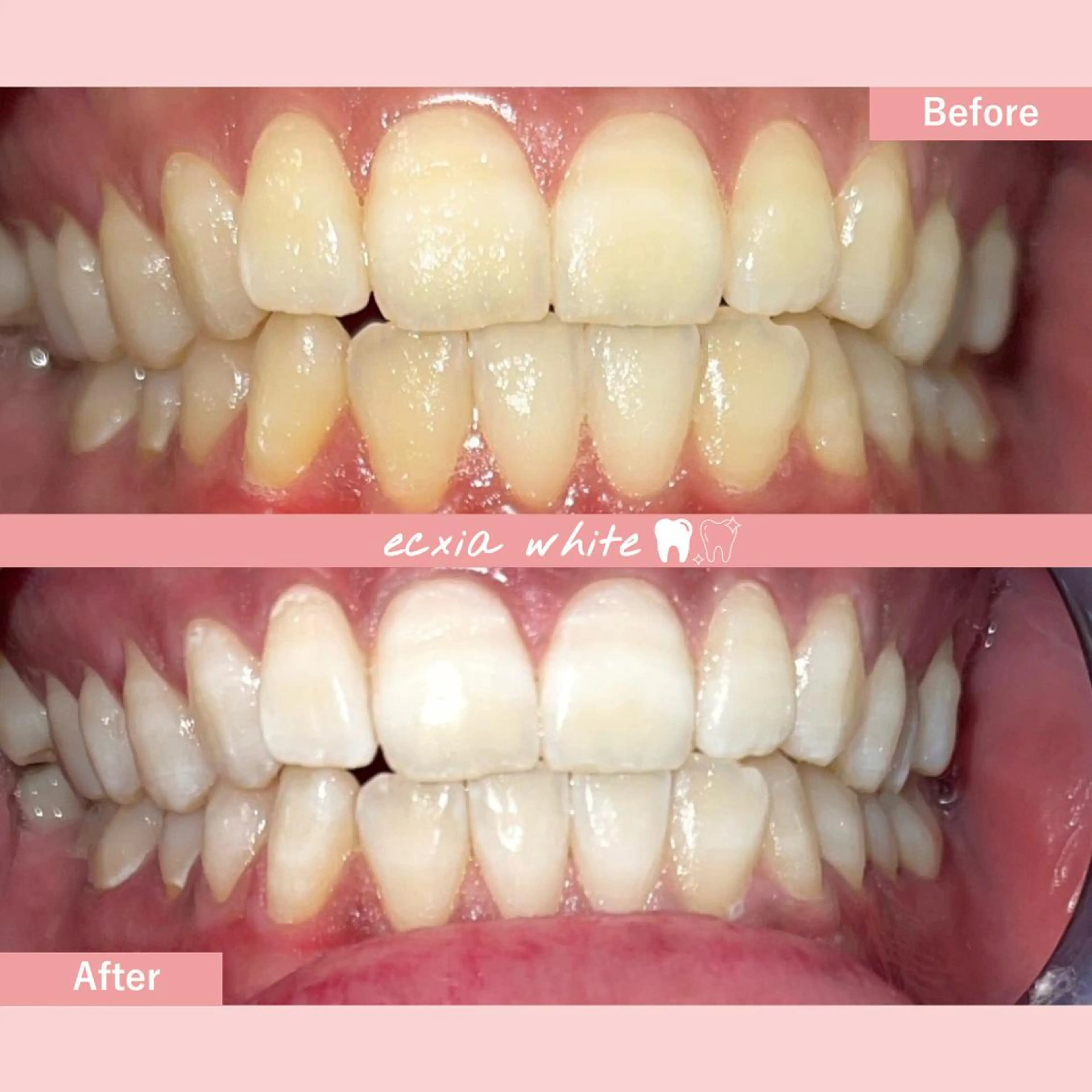 セルフホワイトニング エクシア中島公園店のその他イメージ