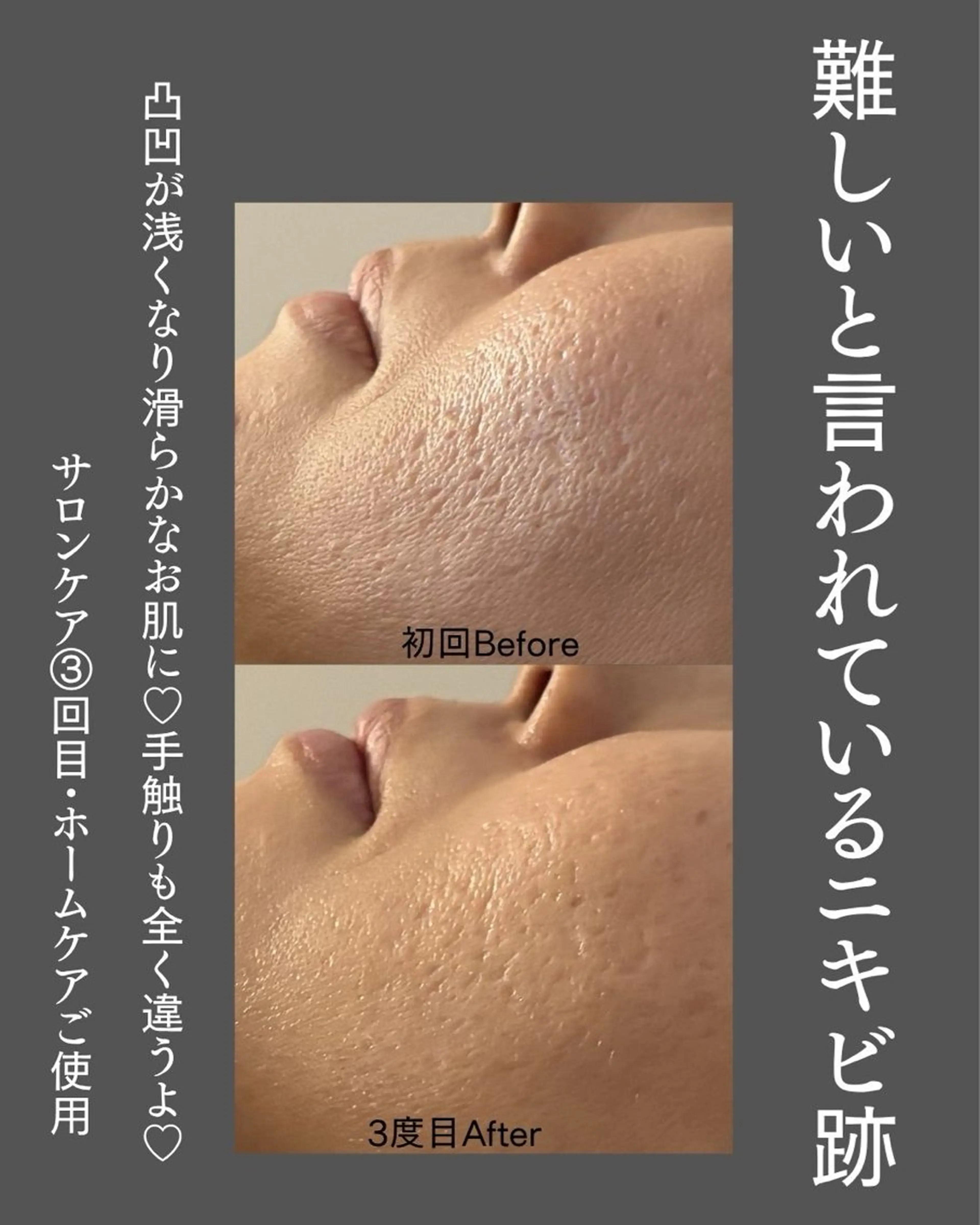 BLOSSOM 菊地のエステ・リラクイメージ