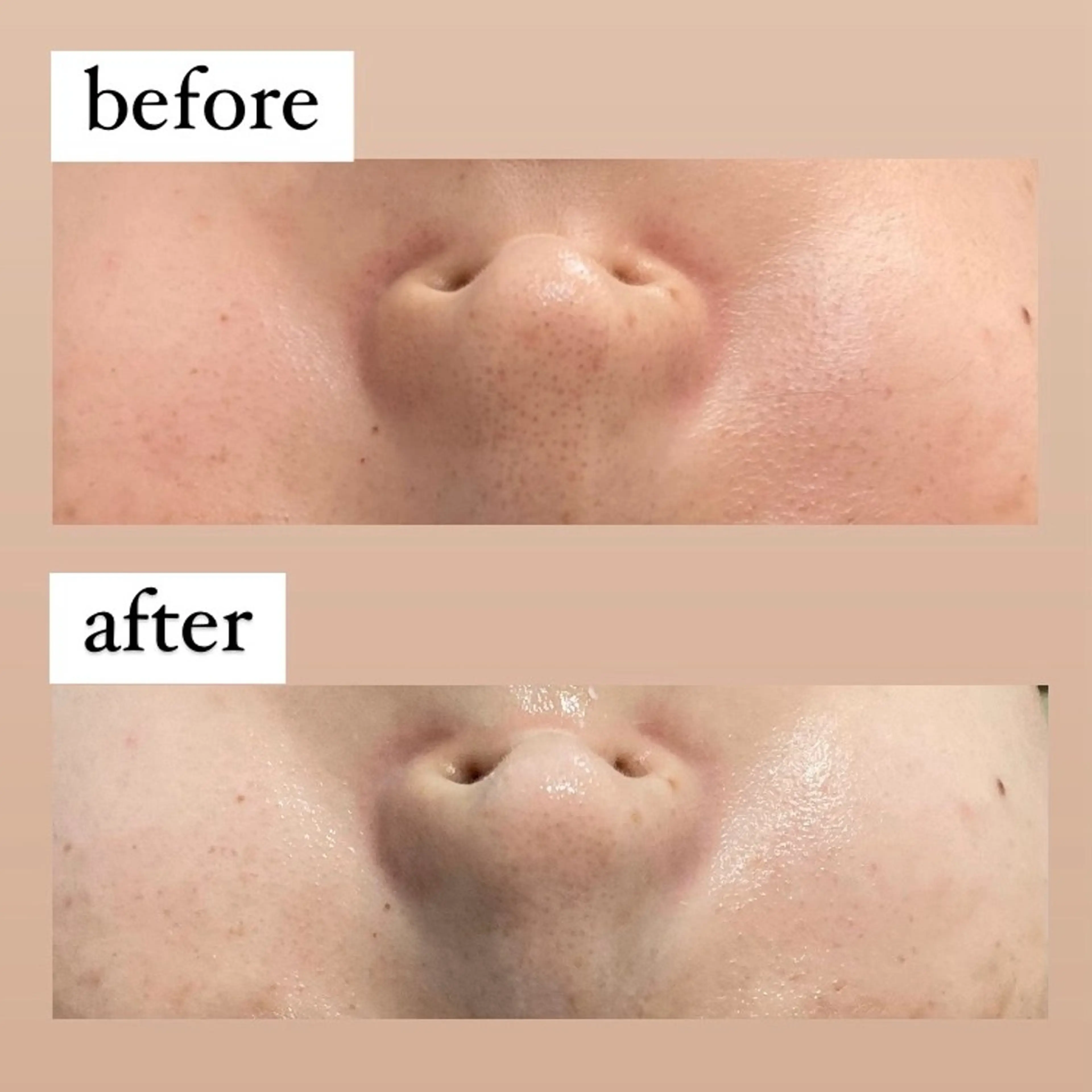 エステ 【韓国肌管理・脱毛】 クレセントのその他イメージ