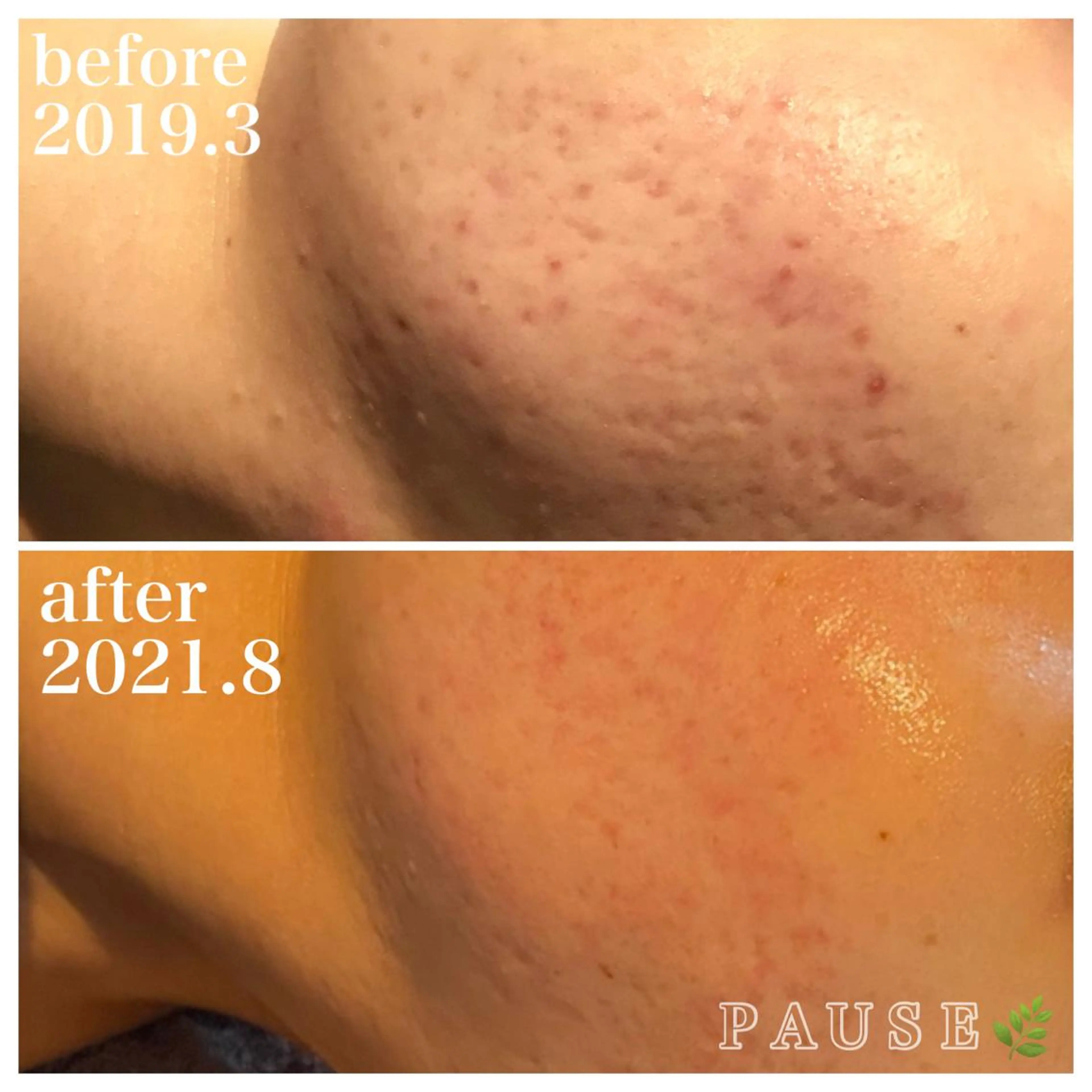 エステ 浜野 恵美のエステ・リラクイメージ