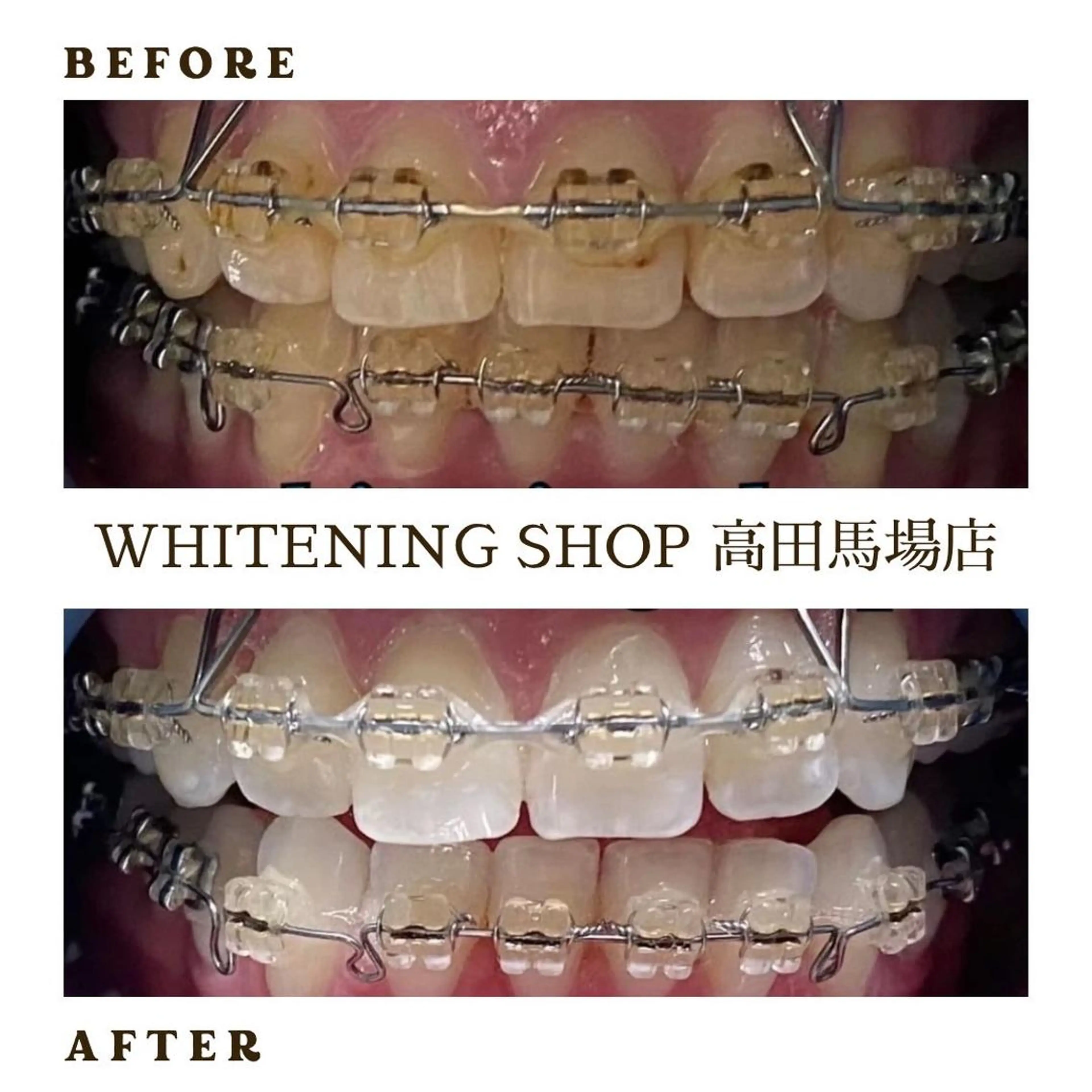 メンズ その他 ホワイトニング ショップ高田馬場店のその他イメージ