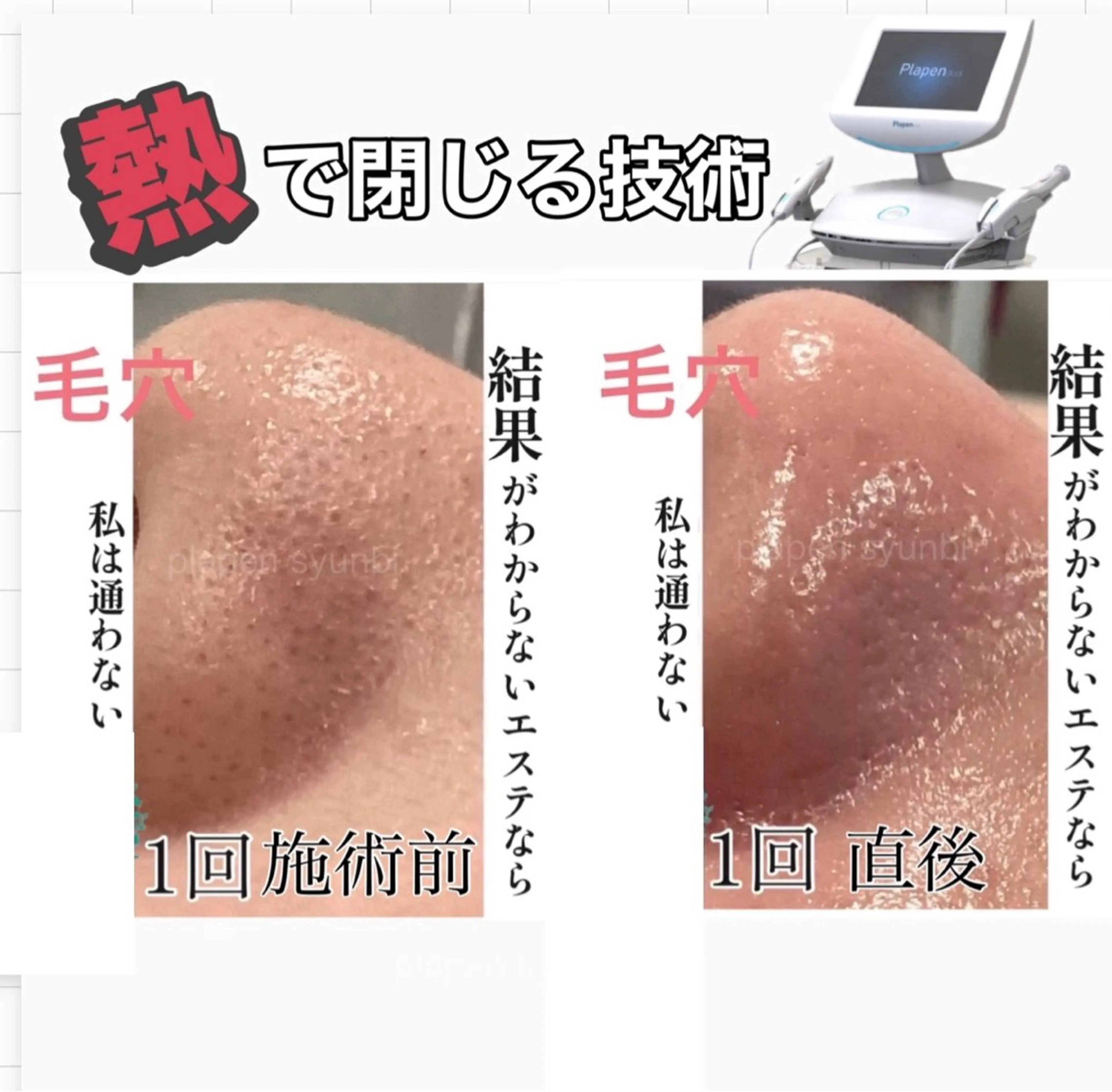 エステ Lumiere despoir所属・Lumiere despoirのエステ・リラクイメージ