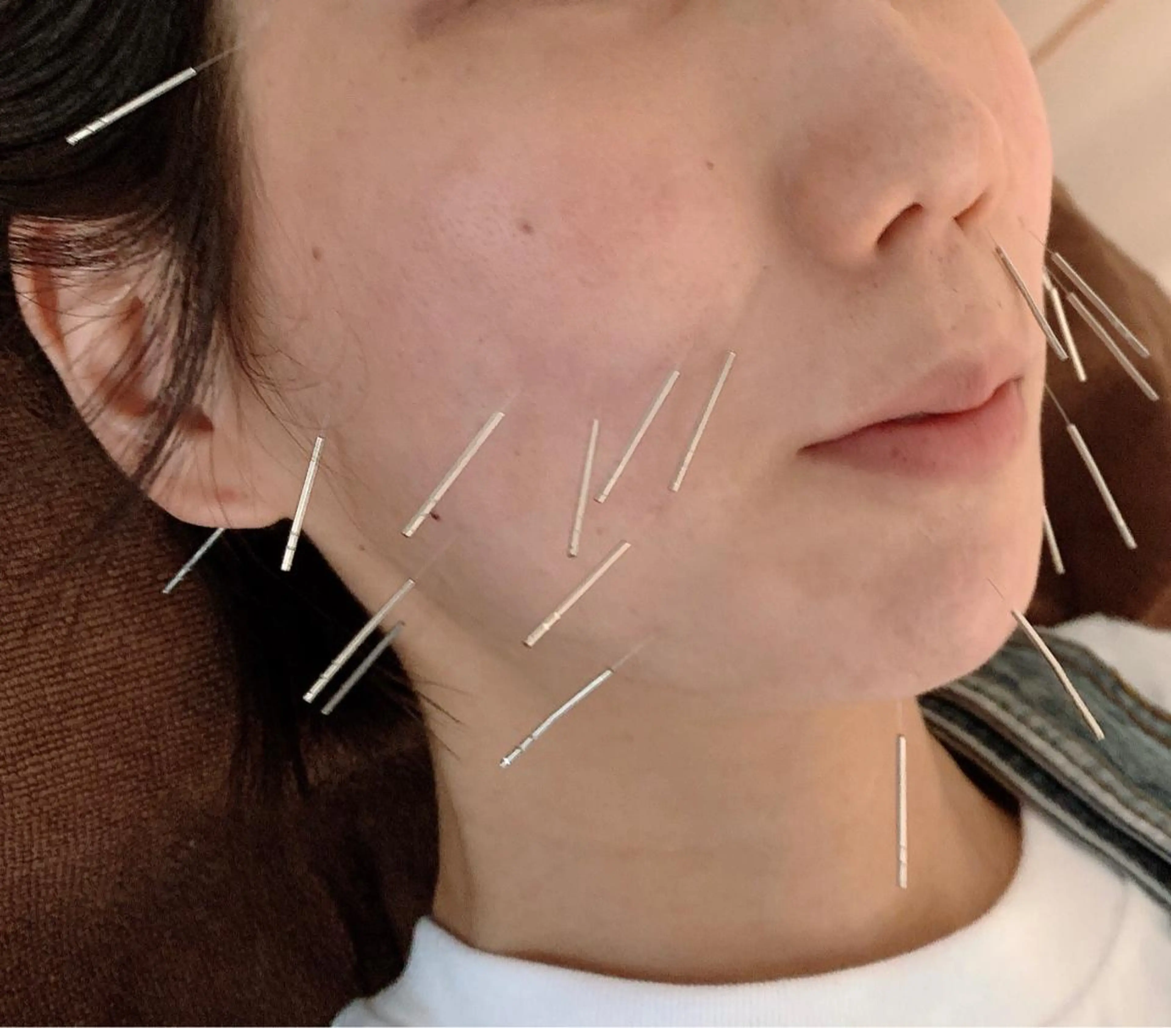 エステ リラク 美容鍼灸イロドリ のエステ・リラクイメージ