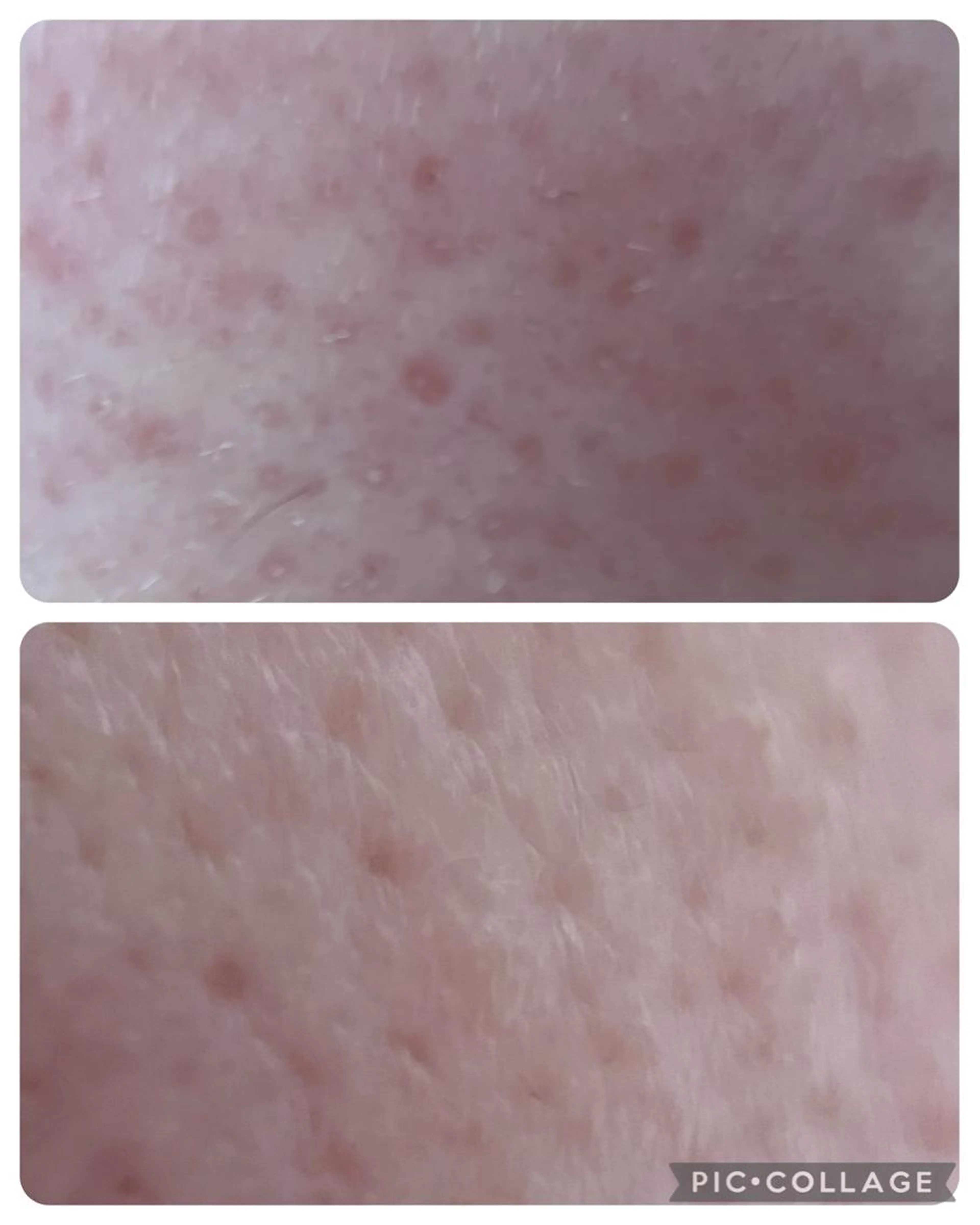 新規の方限定！人気No.1 お肌引き上げコースの写真