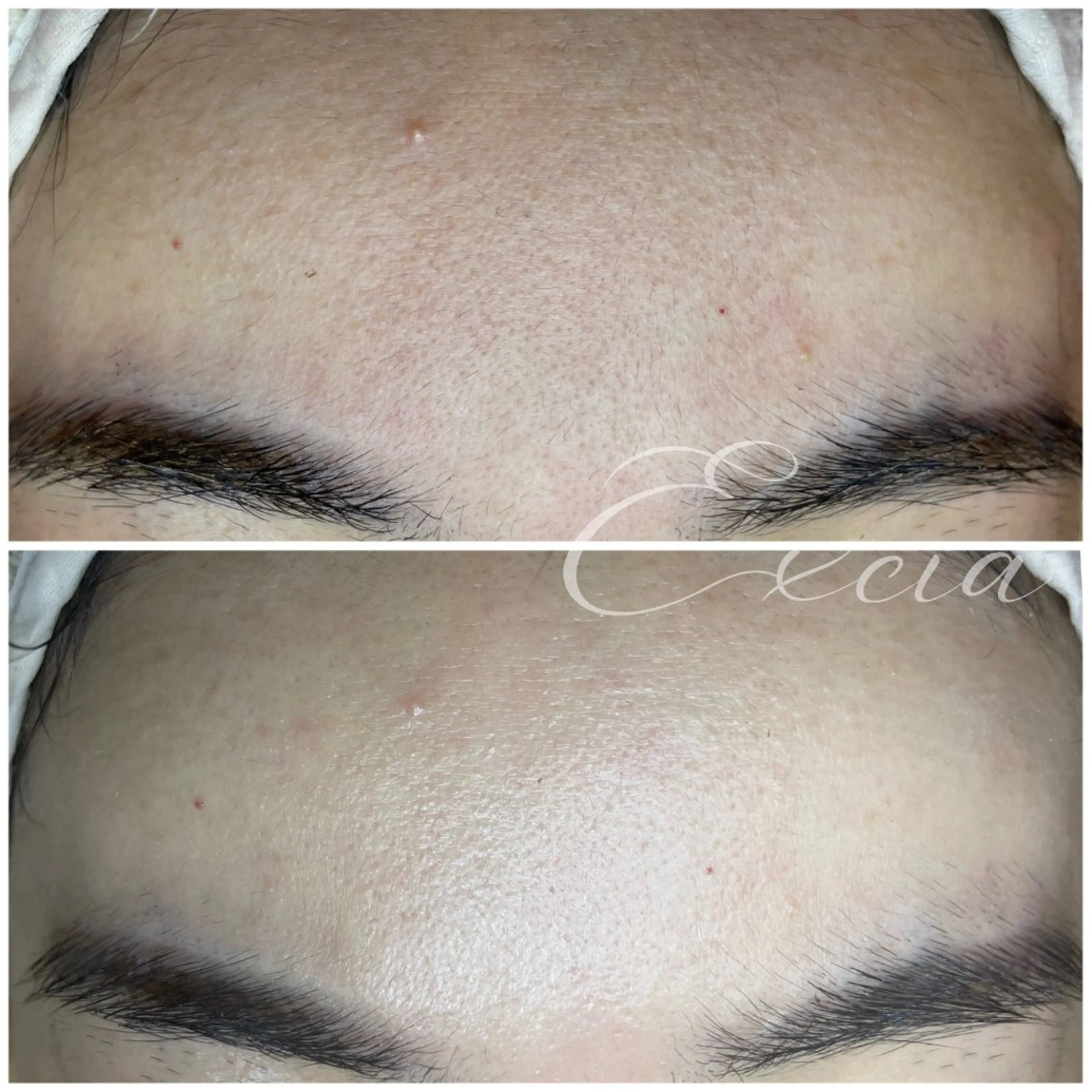 EXCIA （エクシア）のエステ・リラクイメージ