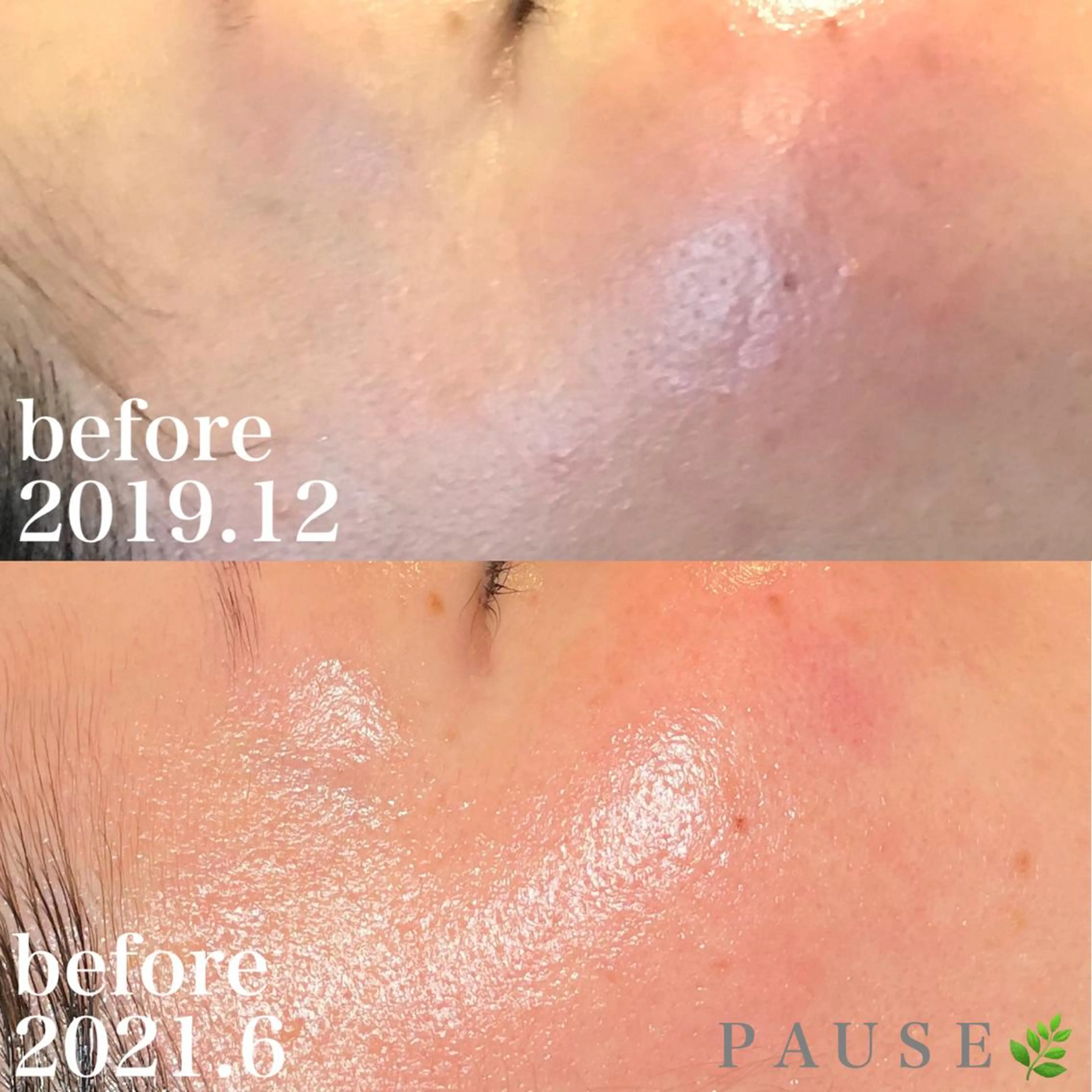 エステ 浜野 恵美のエステ・リラクイメージ