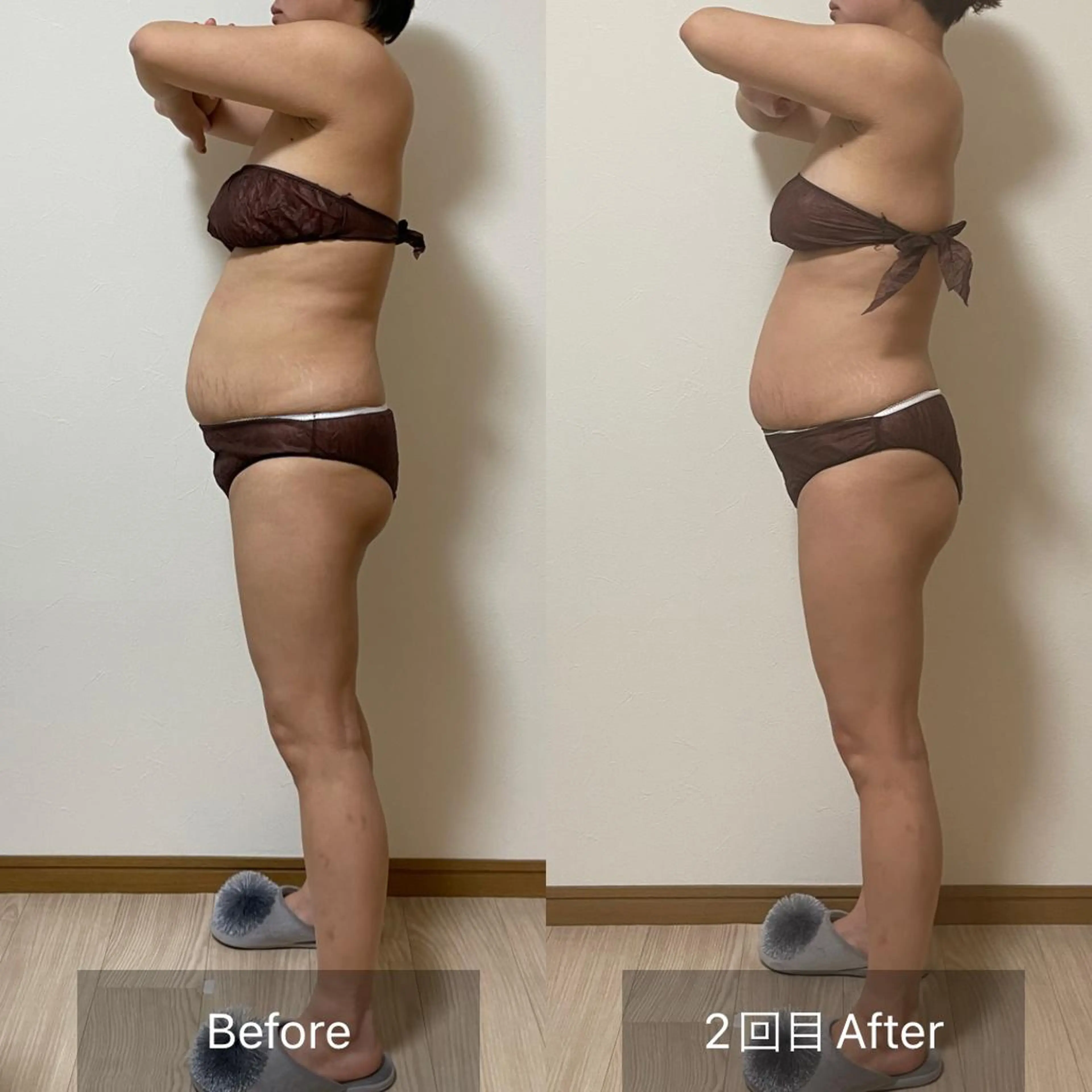 未病ケアサロン　EMINY所属・未病ケアサロン EMINY☺︎勝俣のエステ・リラクイメージ