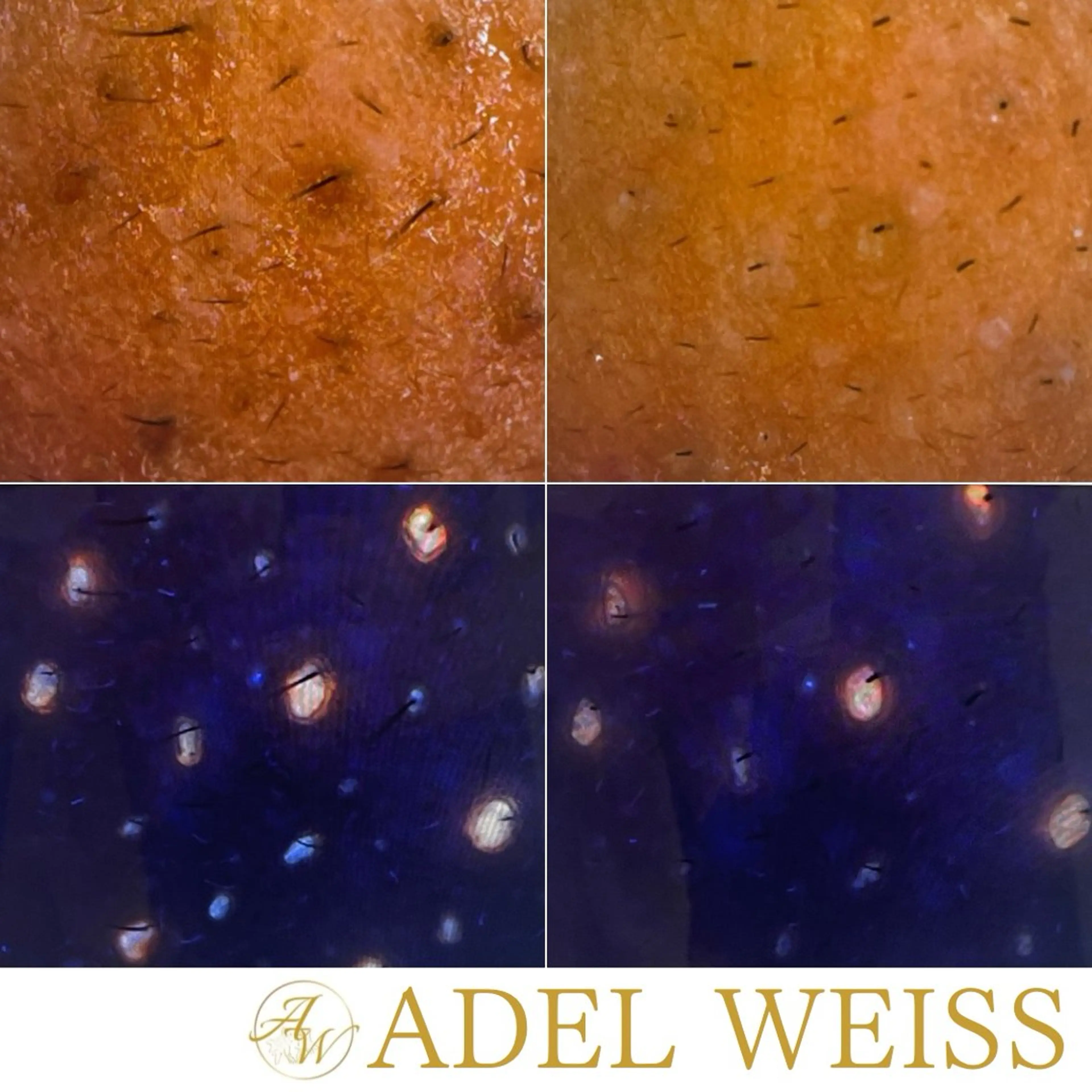 エステ リラク ADEL WEISS 脱毛＆毛穴＆リンパのその他イメージ