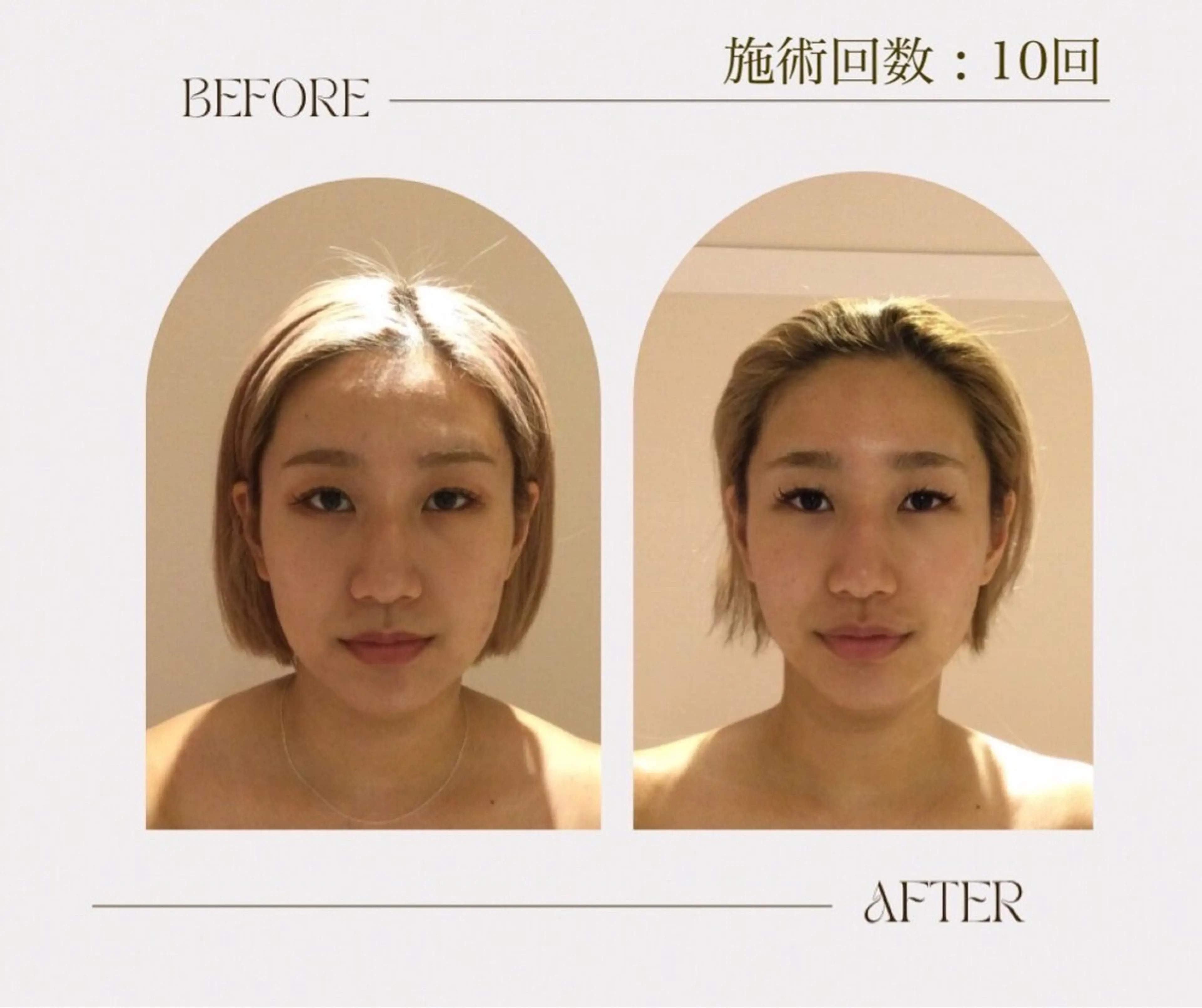 韓国式小顔コルギ BE-CUTE北参道のエステ・リラクイメージ