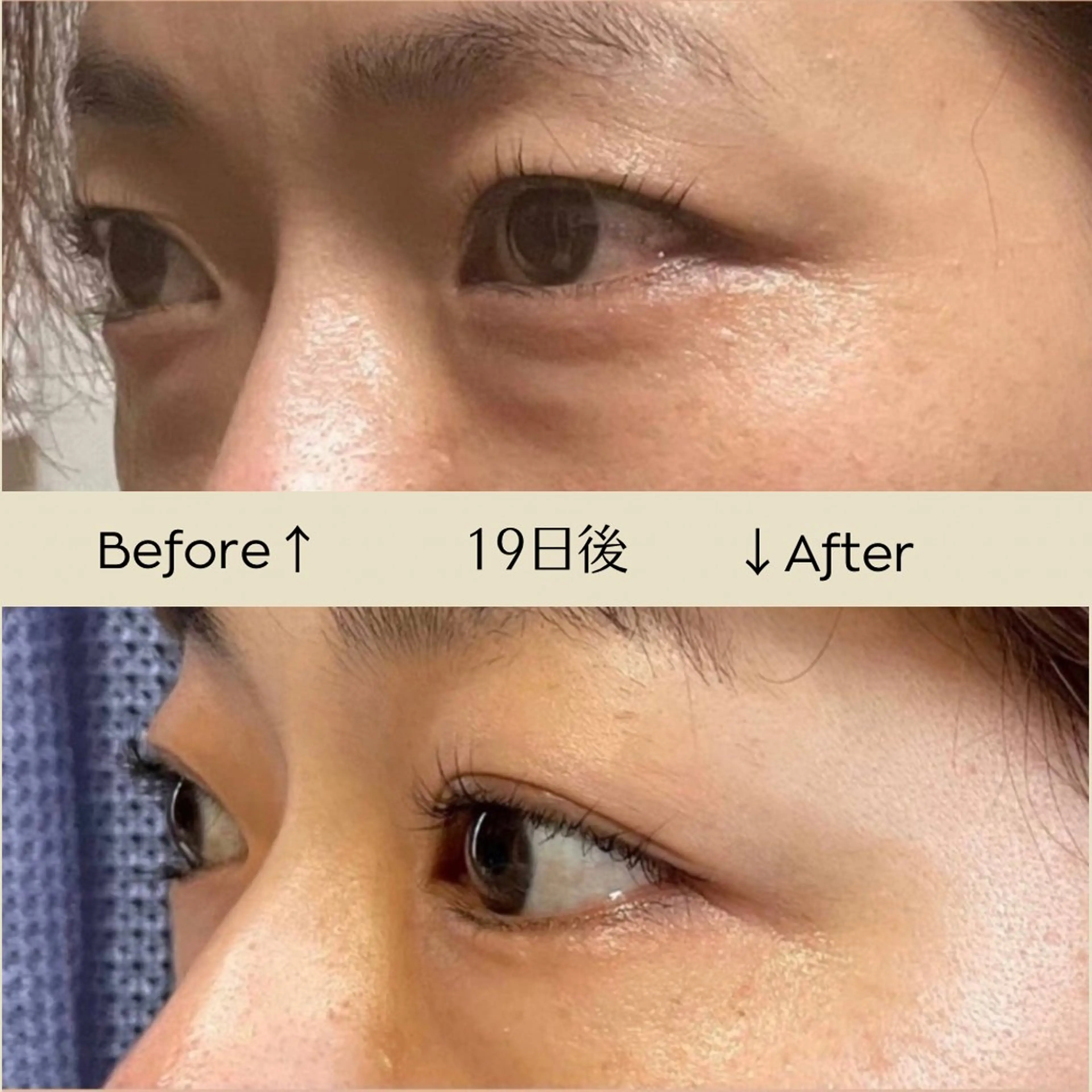 エステ リラク Luce所属・Luce Shokoのエステ・リラクイメージ