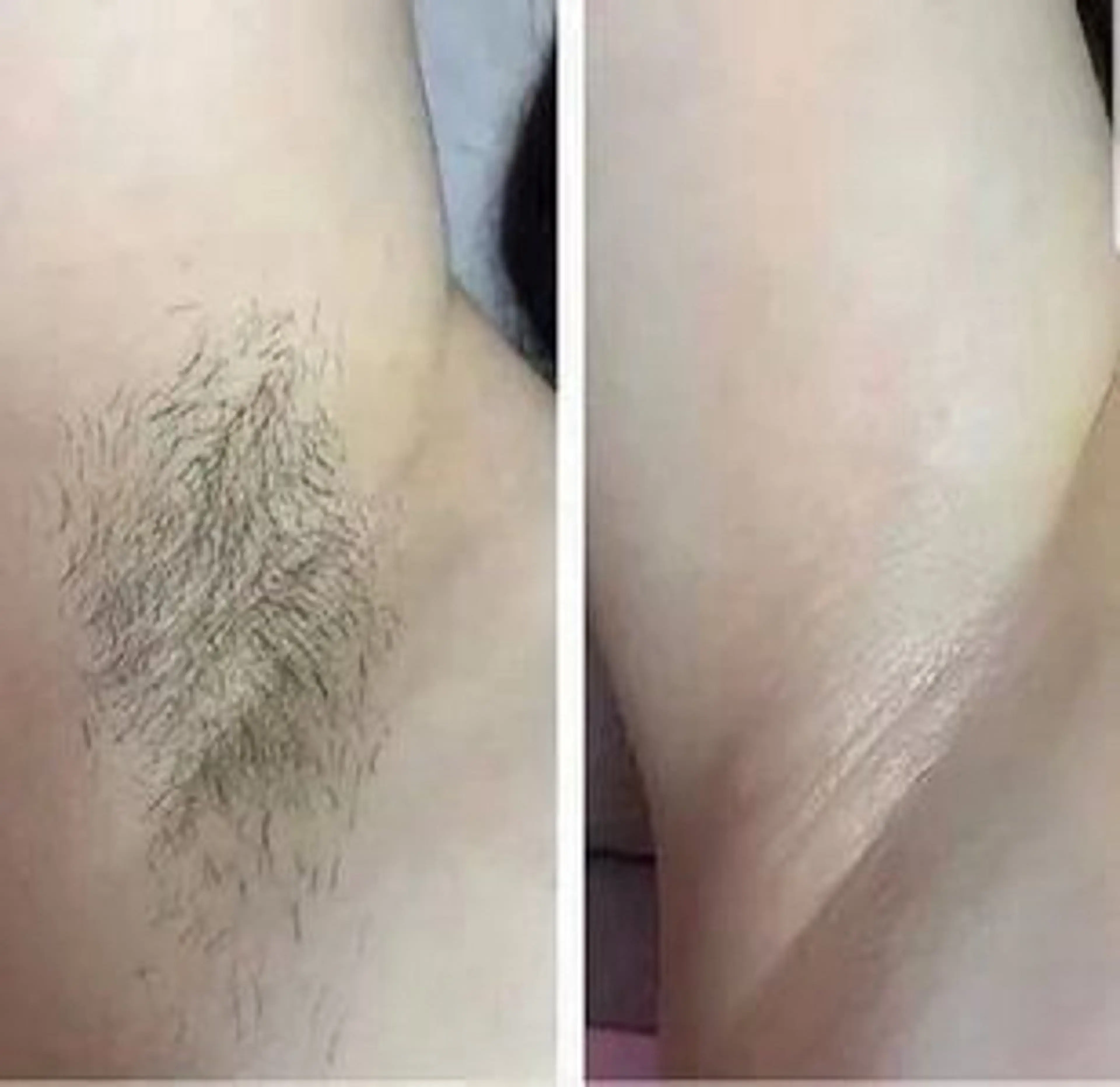 脱毛 Lumus Solarumのエステ・リラクイメージ