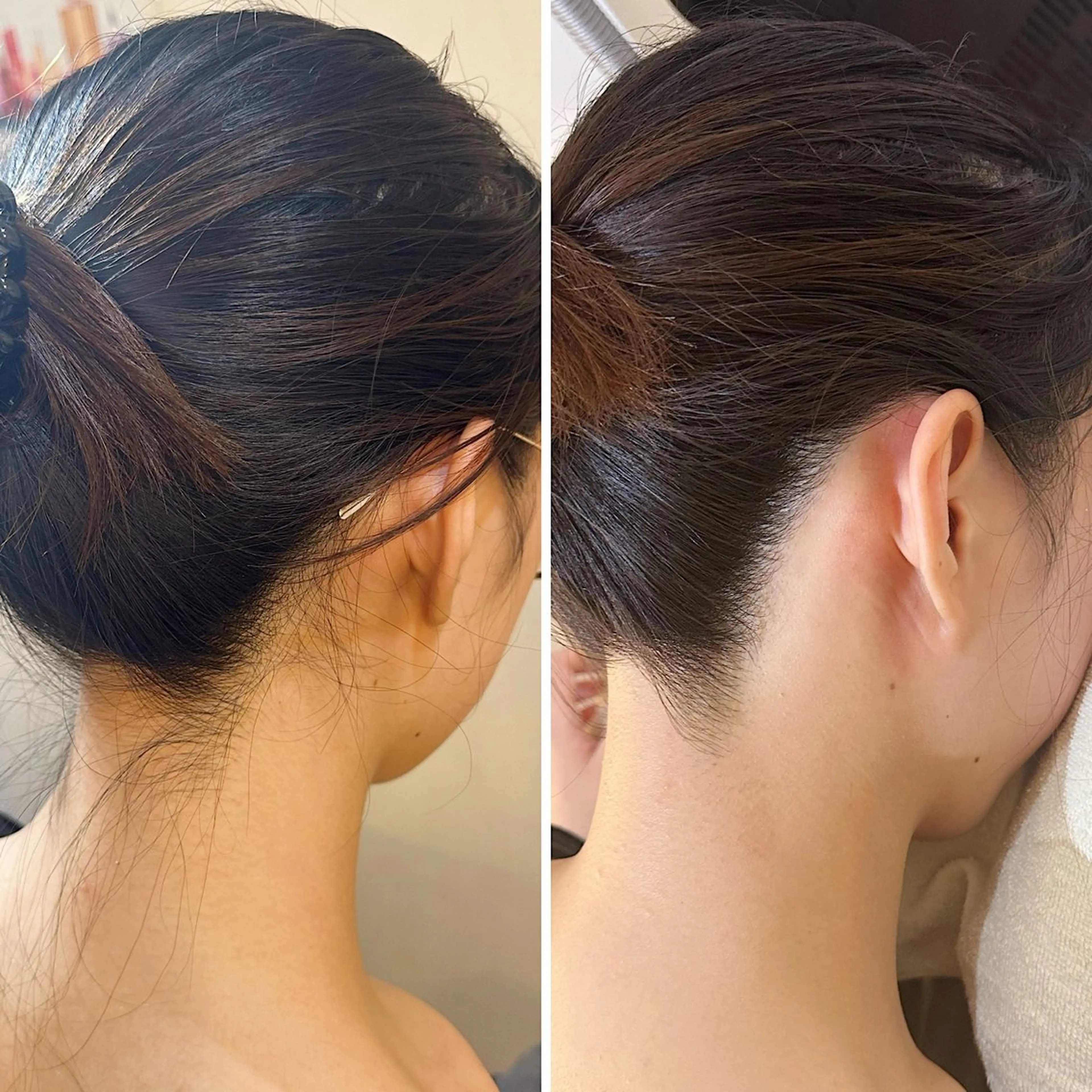 脱毛 うなじ脱毛/美肌脱毛 LABELのエステ・リラクイメージ