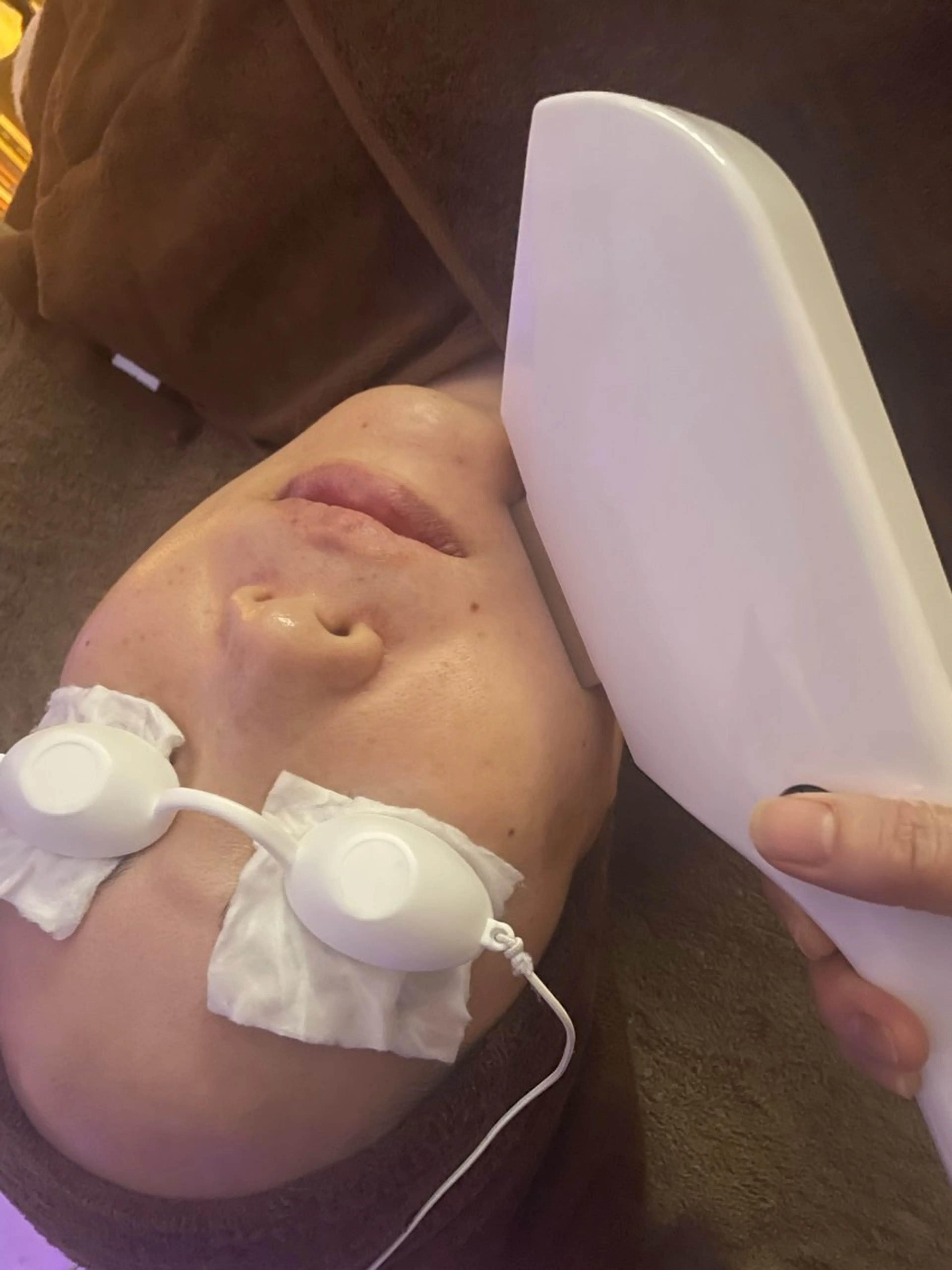 光フェイシャル🍃ミニモ限定初回の写真