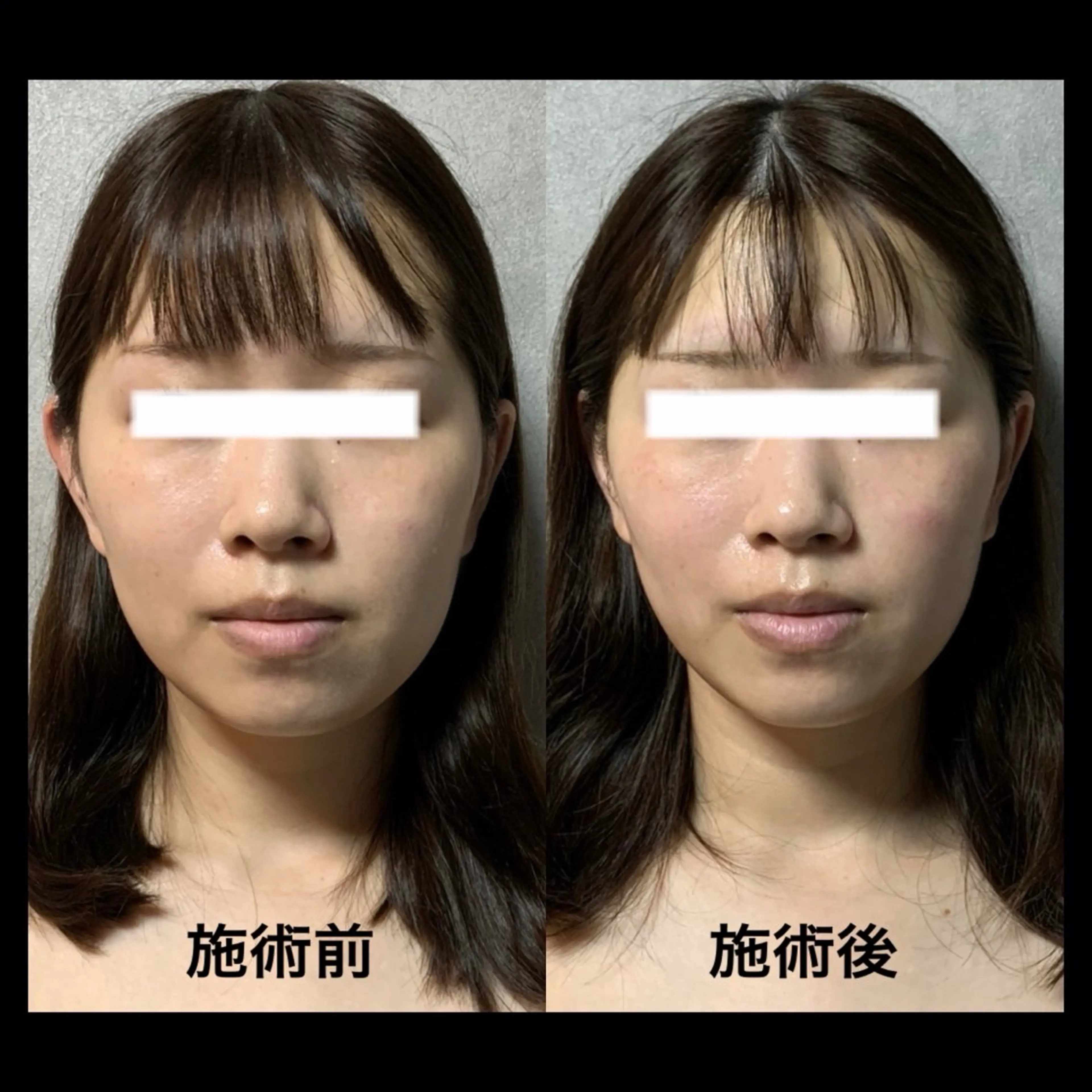 美顔・小顔専門店 LOUISの眉毛・アイブロウイメージ