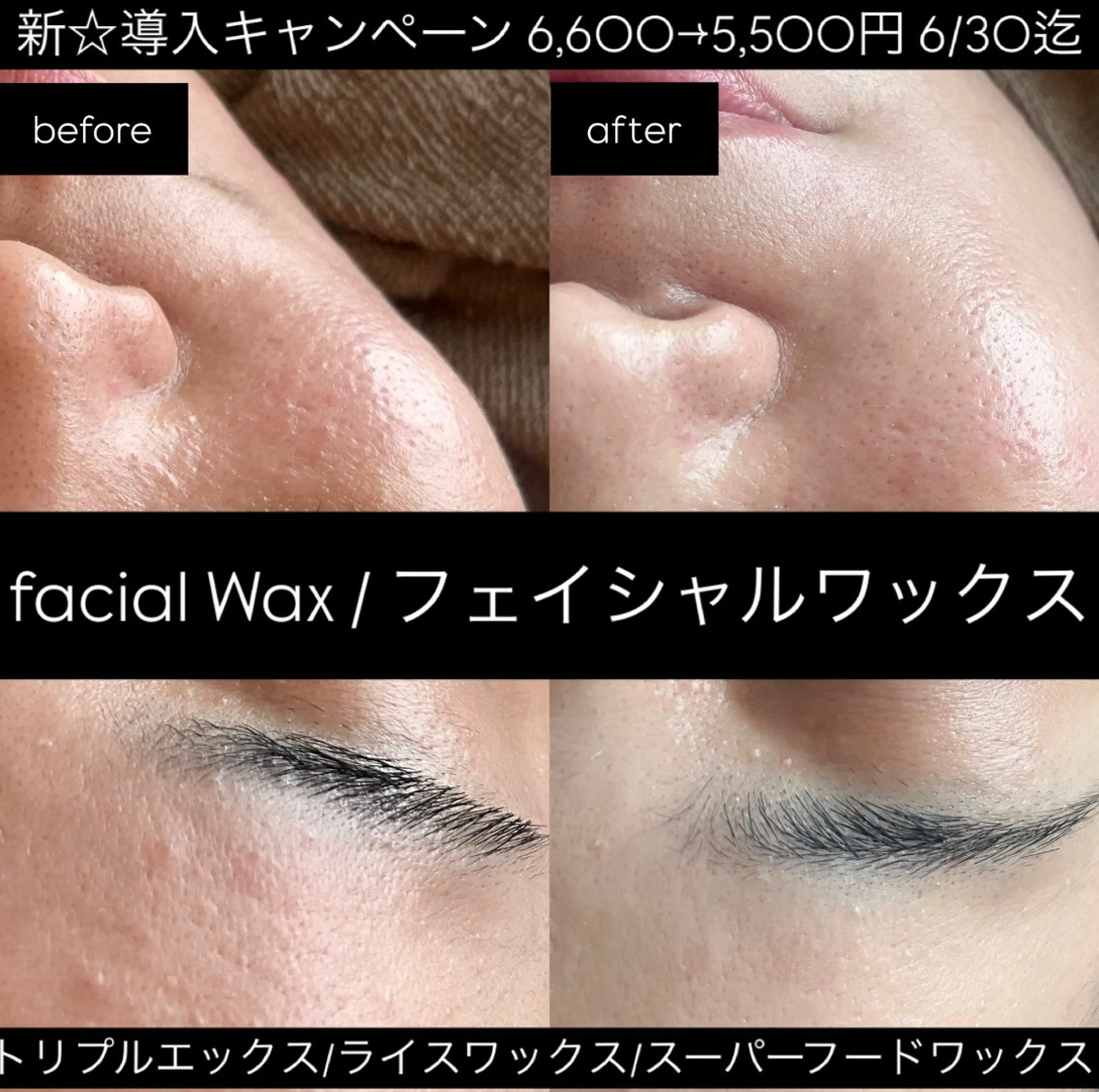 エステ eclair エクレイルのエステ・リラクイメージ