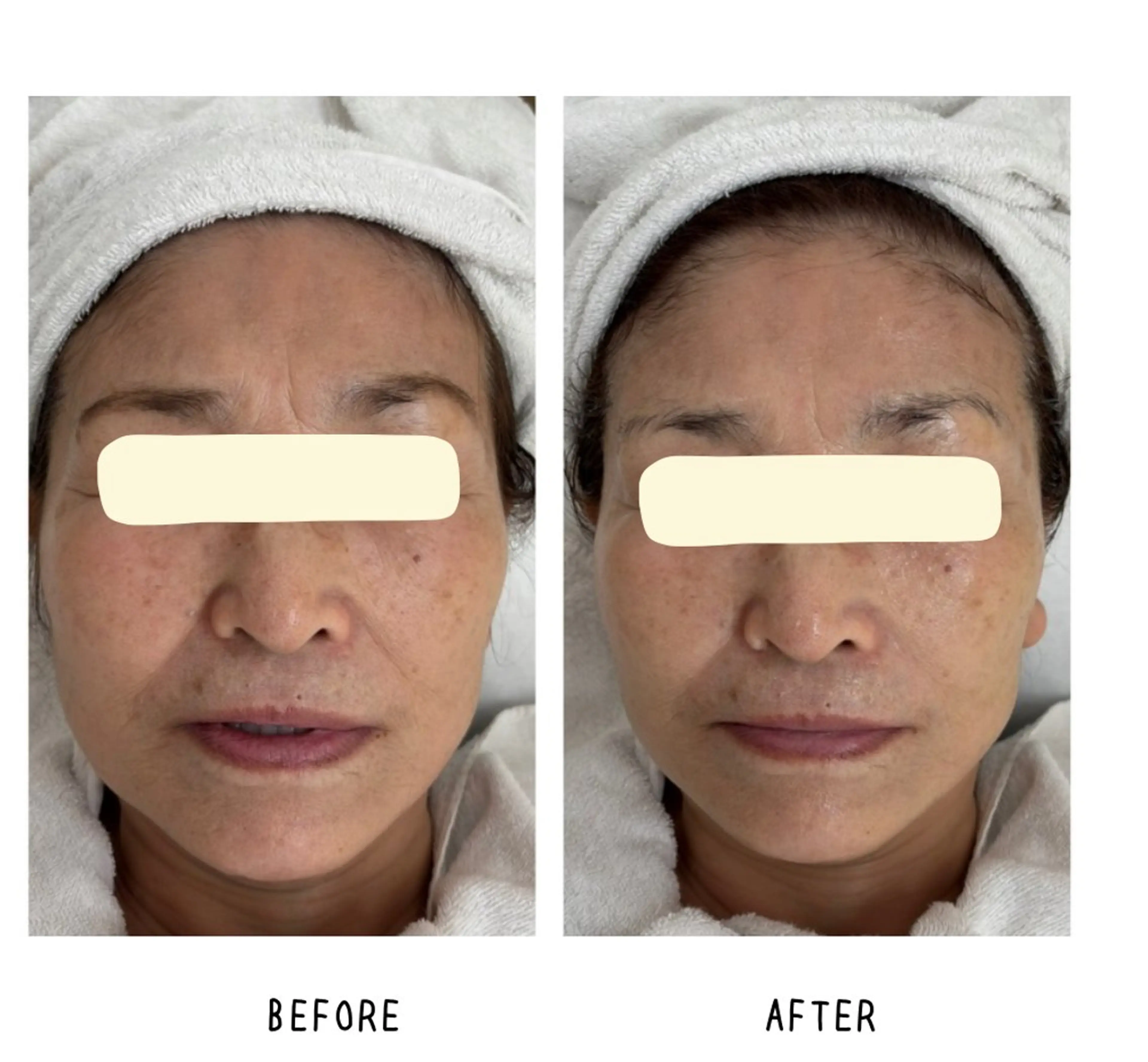 Yoshino Erinaのエステ・リラクイメージ