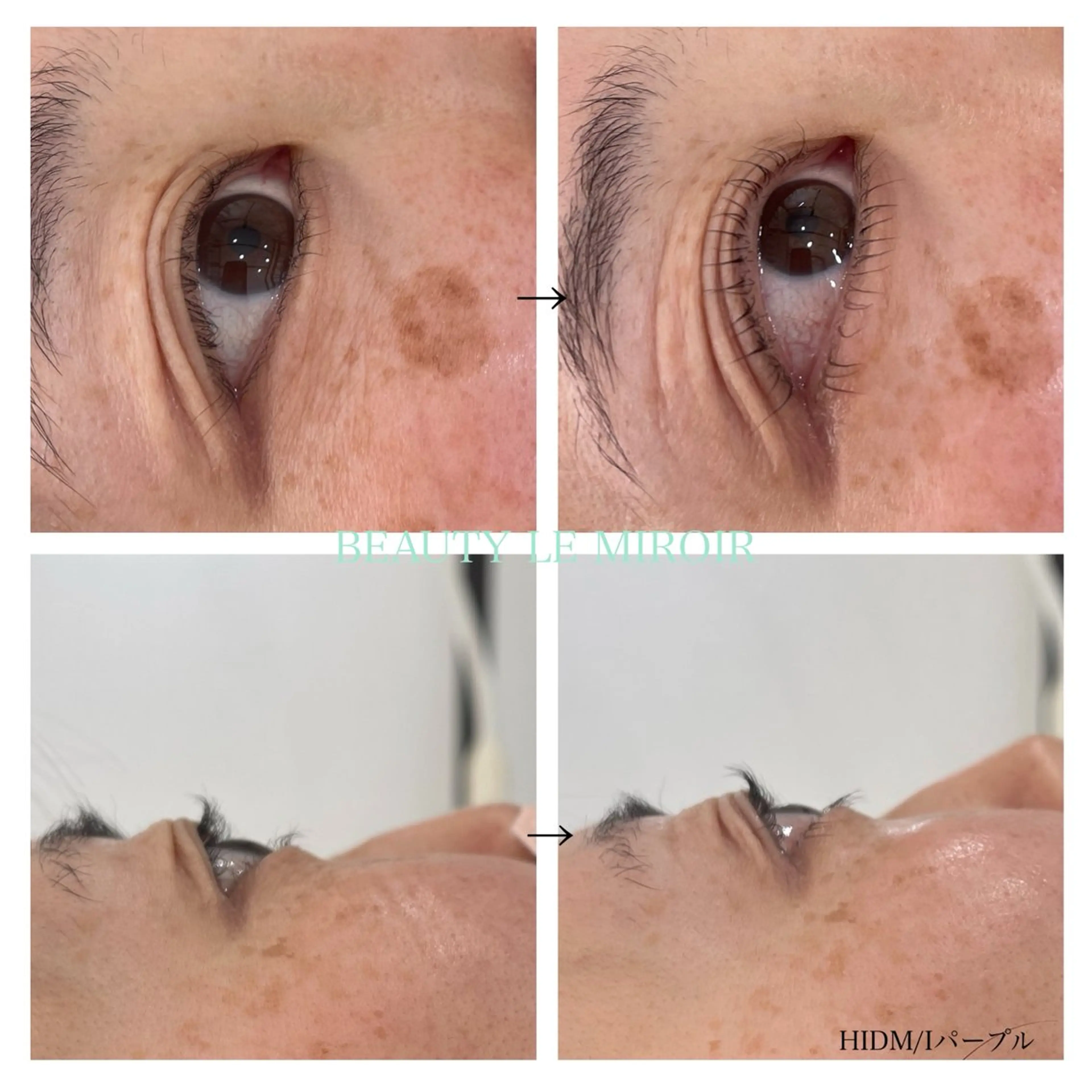 マツエク・マツパ ビューティー ミロワールのエステ・リラクイメージ