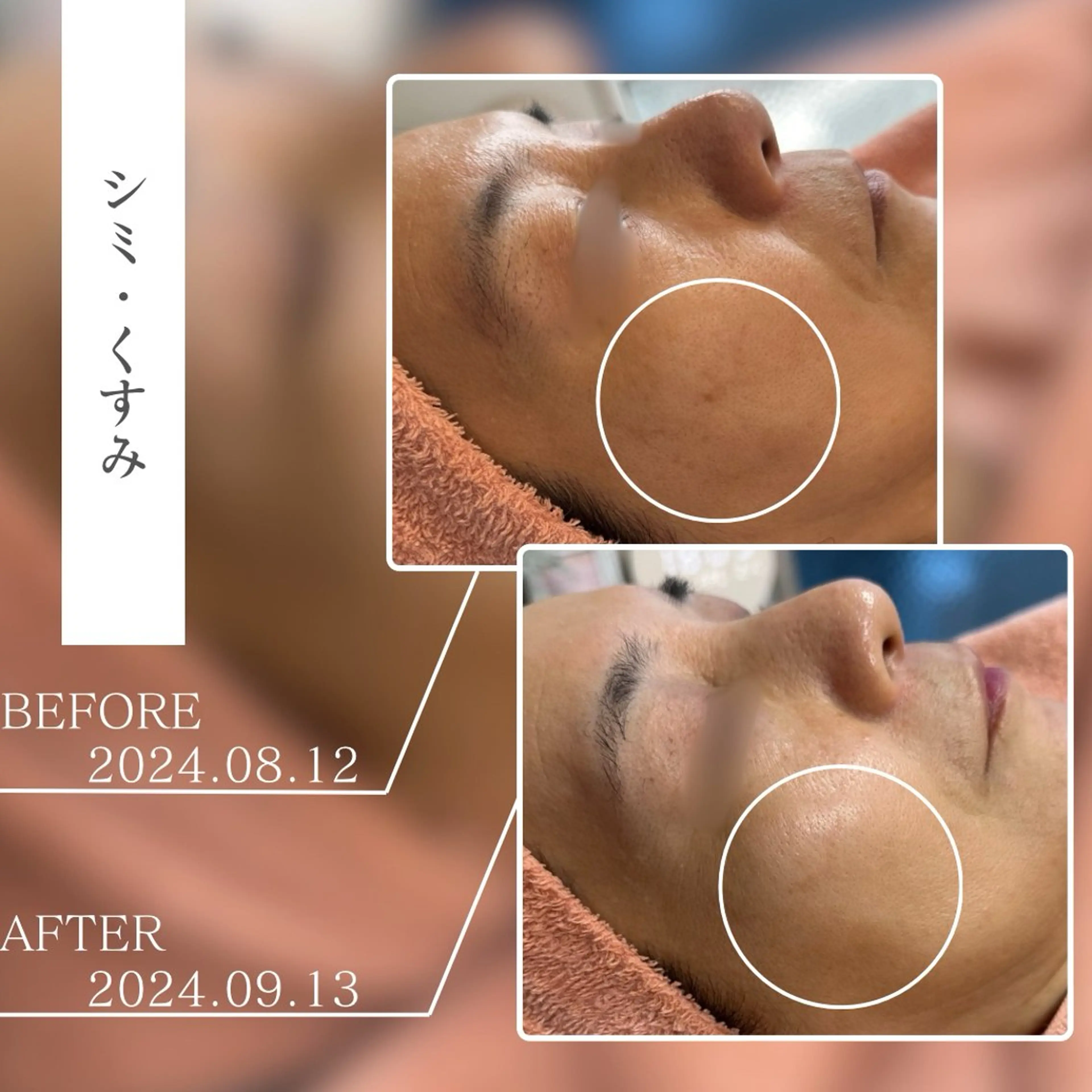 キッズ エステ BestBelleꕤ 大阪福島/肌質改善のエステ・リラクイメージ