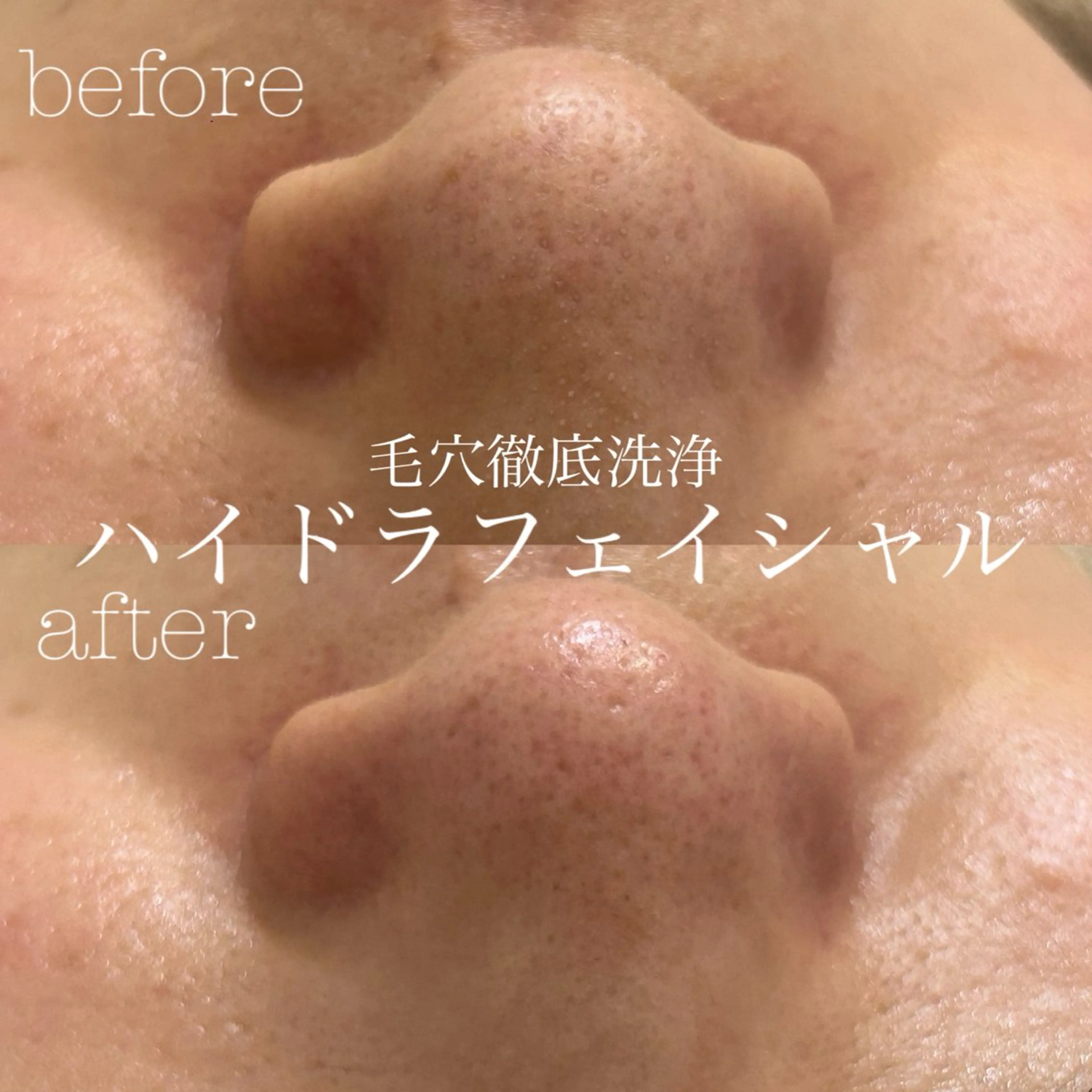 エステ フェイシャルサロン CHIARA 荒田のエステ・リラクイメージ