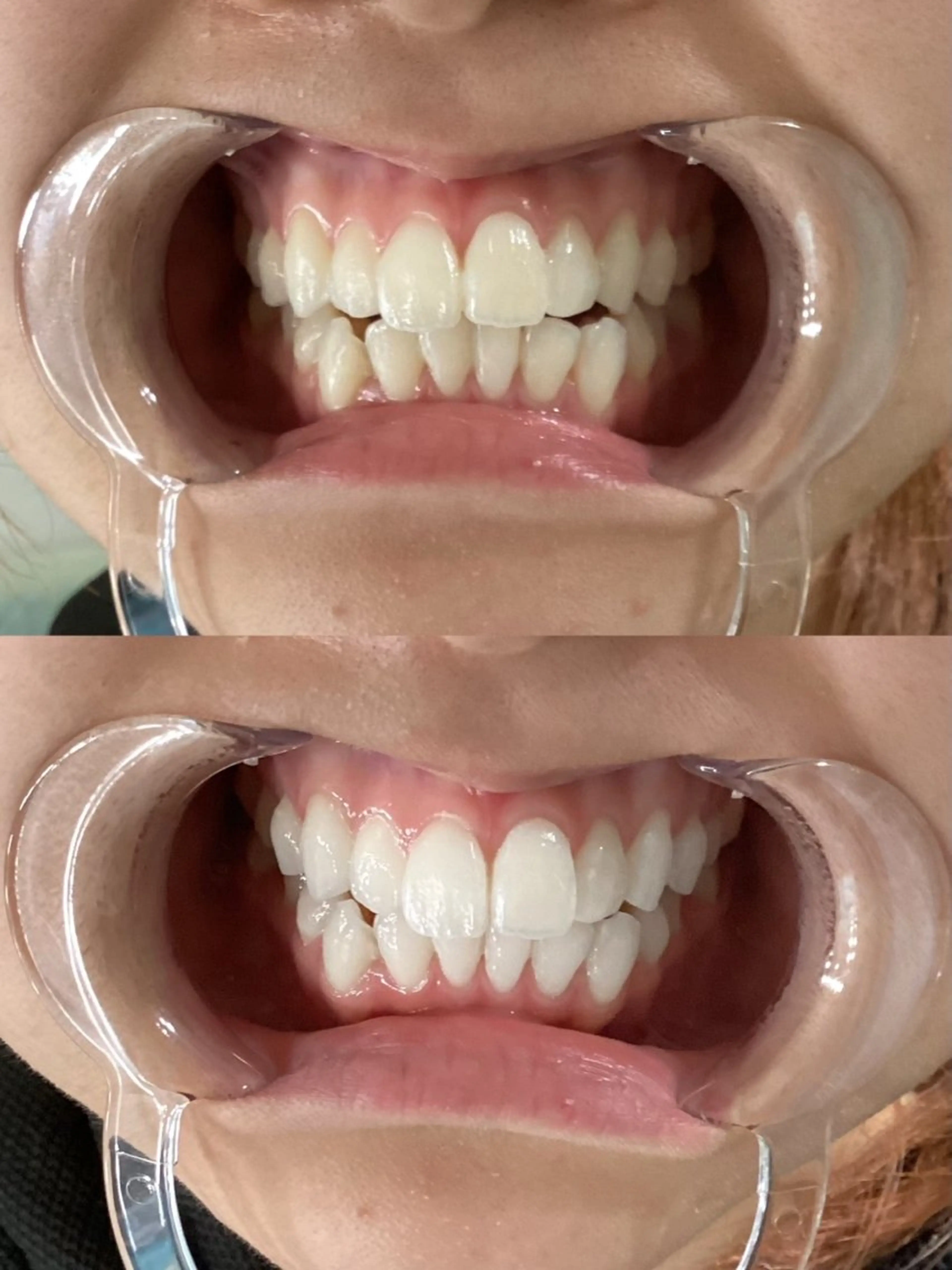 ホワイティアビシェル ウラワ　白澤奇のエステ・リラクイメージ